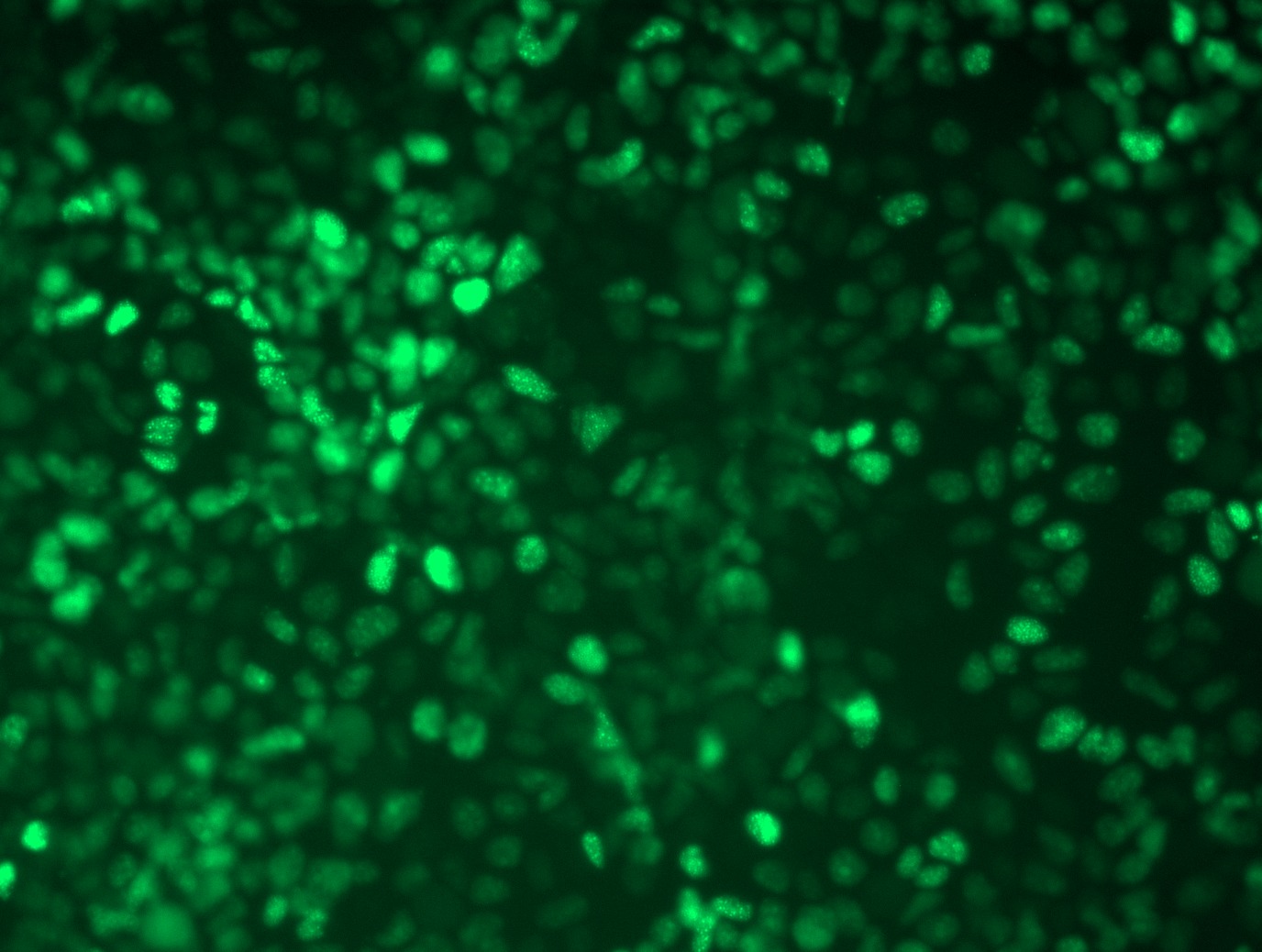 <a href = "https://www.origene.com/catalog/cdna-clones/expression-plasmids/rc213479l4-c11orf57-nkapd1-nm-018195-human-tagged-lenti-orf-clone" title="RC213479L4" class="">RC213479L4</a> was used to prepare Lentiviral particles using <a href = "https://www.origene.com/catalog/others/lentiviral-packaging-kits/tr30037-lentiviral-packaging-kits" title="TR30037" class="">TR30037</a> packaging kit. HEK293T cells were transduced with RC213479L4V particle to overexpress human NKAPD1-mGFP fusion protein.