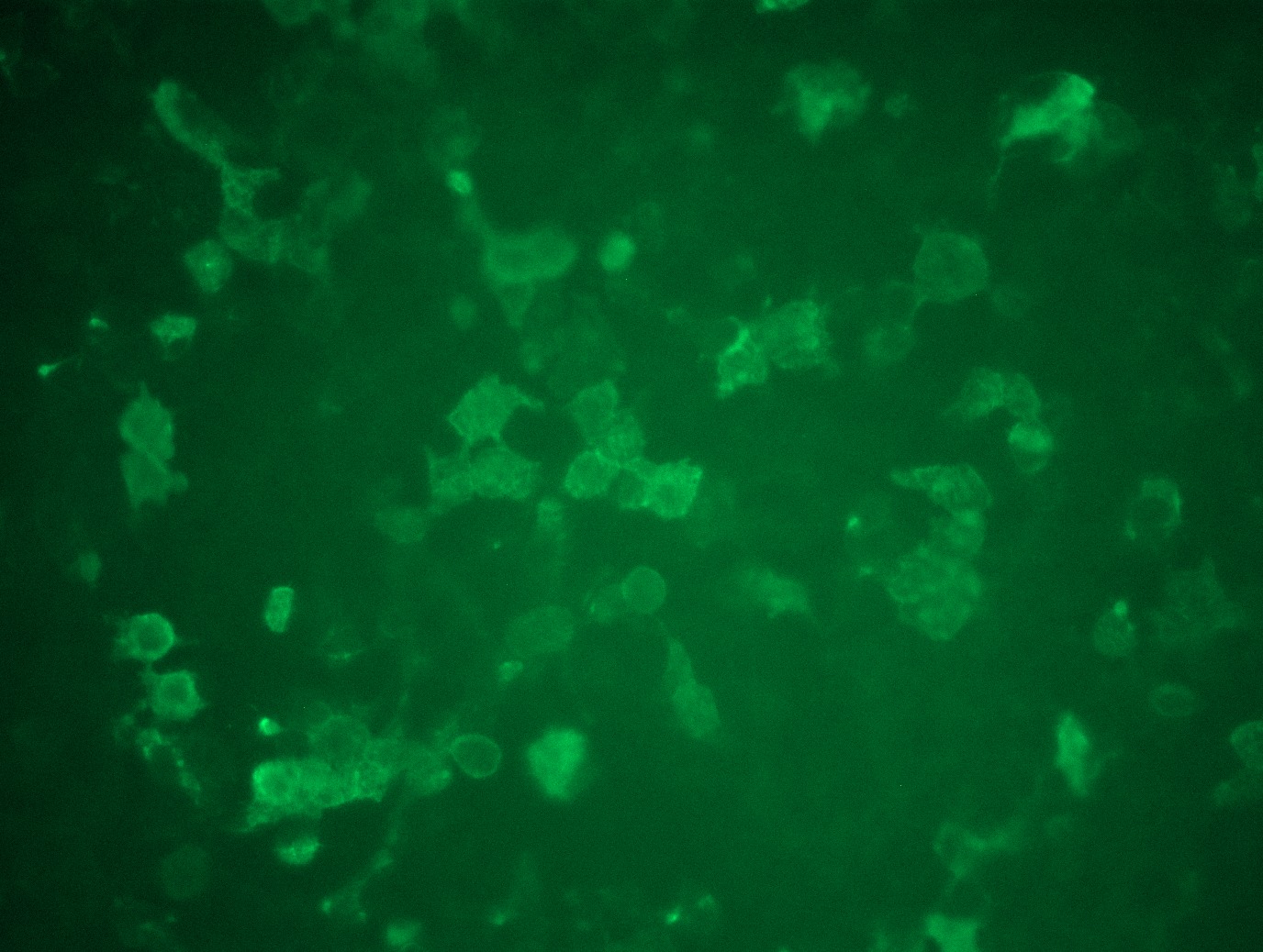 <a href = "https://www.origene.com/catalog/cdna-clones/expression-plasmids/rc214928l3-igf1-receptor-igf1r-nm-000875-human-tagged-lenti-orf-clone" title="RC214928L3" class="">RC214928L3</a> was used to prepare Lentiviral particles using <a href = "https://www.origene.com/catalog/others/lentiviral-packaging-kits/tr30037-lentiviral-packaging-kits" title="TR30037" class="">TR30037</a> packaging kit. HEK293T cells were transduced with RC214928L3V particle to overexpress human IGF1R-Myc-DDK fusion protein.