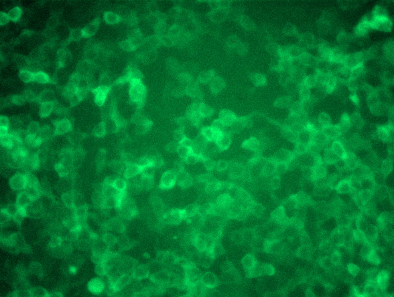 <a href = "https://www.origene.com/catalog/cdna-clones/expression-plasmids/rc215316l4-androgen-receptor-ar-nm-000044-human-tagged-lenti-orf-clone" title="RC215316L4" class="">RC215316L4</a> was used to prepare Lentiviral particles using <a href = "https://www.origene.com/catalog/others/lentiviral-packaging-kits/tr30037-lentiviral-packaging-kits" title="TR30037" class="">TR30037</a> packaging kit. HEK293T cells were transduced with RC215316L4V particle to overexpress human AR-mGFP fusion protein.