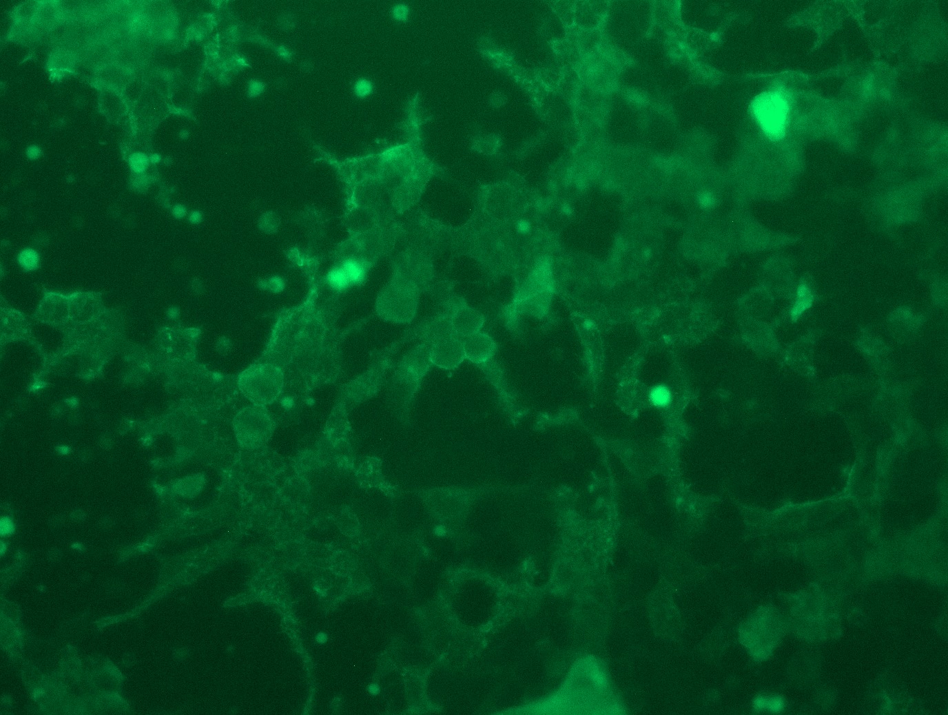 RC215640L3 was used to prepare Lentiviral particles using TR30037 packaging kit. HEK293T cells were transduced with RC215640L3V particle to overexpress human ROR2-Myc-DDK fusion protein.