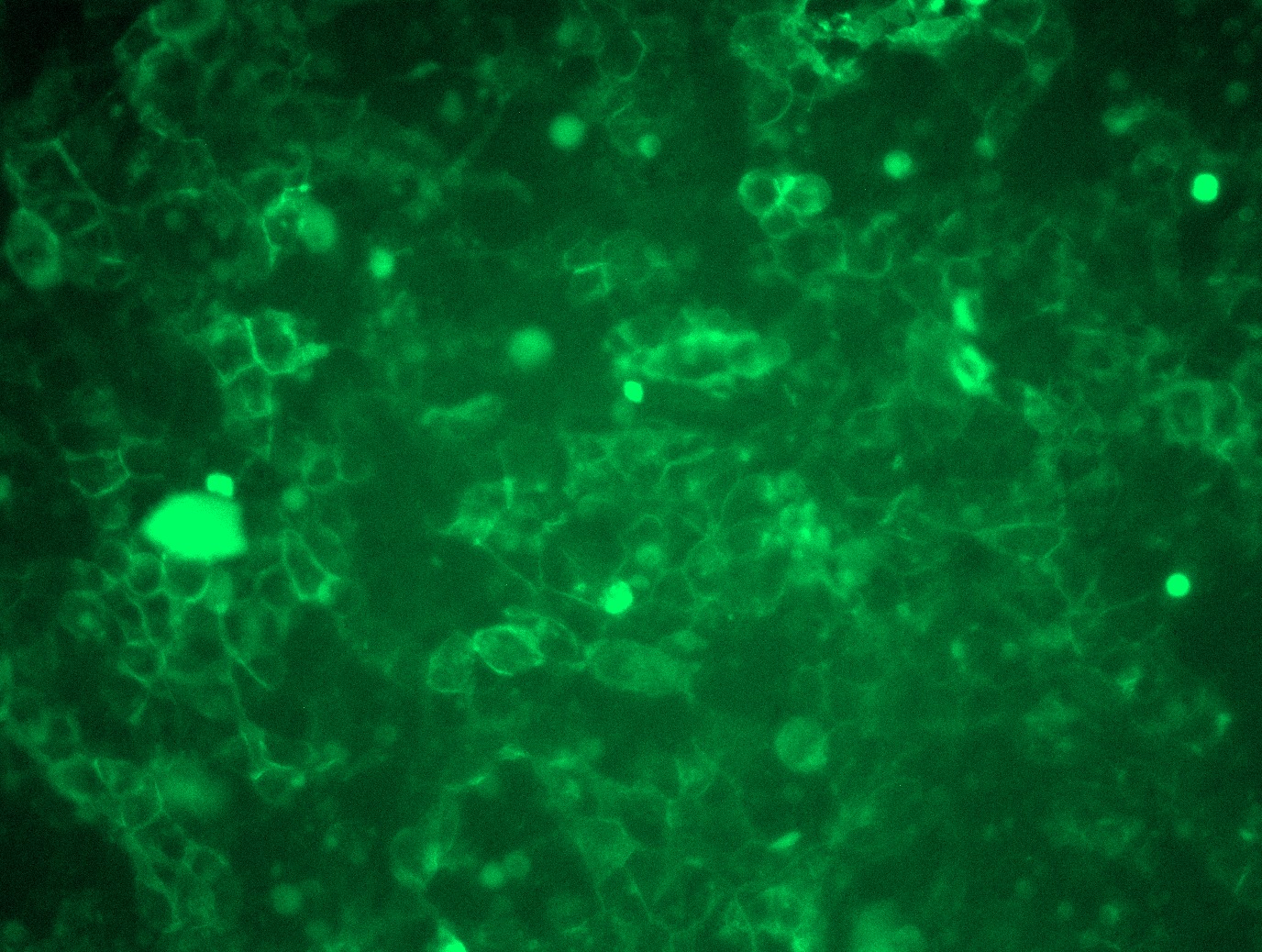 <a href = "https://www.origene.com/catalog/cdna-clones/expression-plasmids/rc215848l3-siglec15-nm-213602-human-tagged-lenti-orf-clone" title="RC215848L3" class="">RC215848L3</a> was used to prepare Lentiviral particles using <a href = "https://www.origene.com/catalog/others/lentiviral-packaging-kits/tr30037-lentiviral-packaging-kits" title="TR30037" class="">TR30037</a> packaging kit. HEK293T cells were transduced with RC215848L3V particle to overexpress human SIGLEC15-Myc-DDK fusion protein.