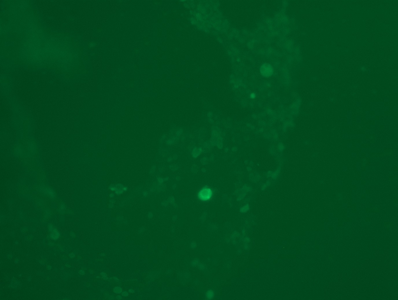 <a href = "https://www.origene.com/catalog/cdna-clones/expression-plasmids/rc216879l3-brd4-nm-014299-human-tagged-lenti-orf-clone" title="RC216879L3" class="">RC216879L3</a> was used to prepare Lentiviral particles using <a href = "https://www.origene.com/catalog/others/lentiviral-packaging-kits/tr30037-lentiviral-packaging-kits" title="TR30037" class="">TR30037</a> packaging kit. HEK293T cells were transduced with RC216879L3V particle to overexpress human BRD4-Myc-DDK fusion protein.