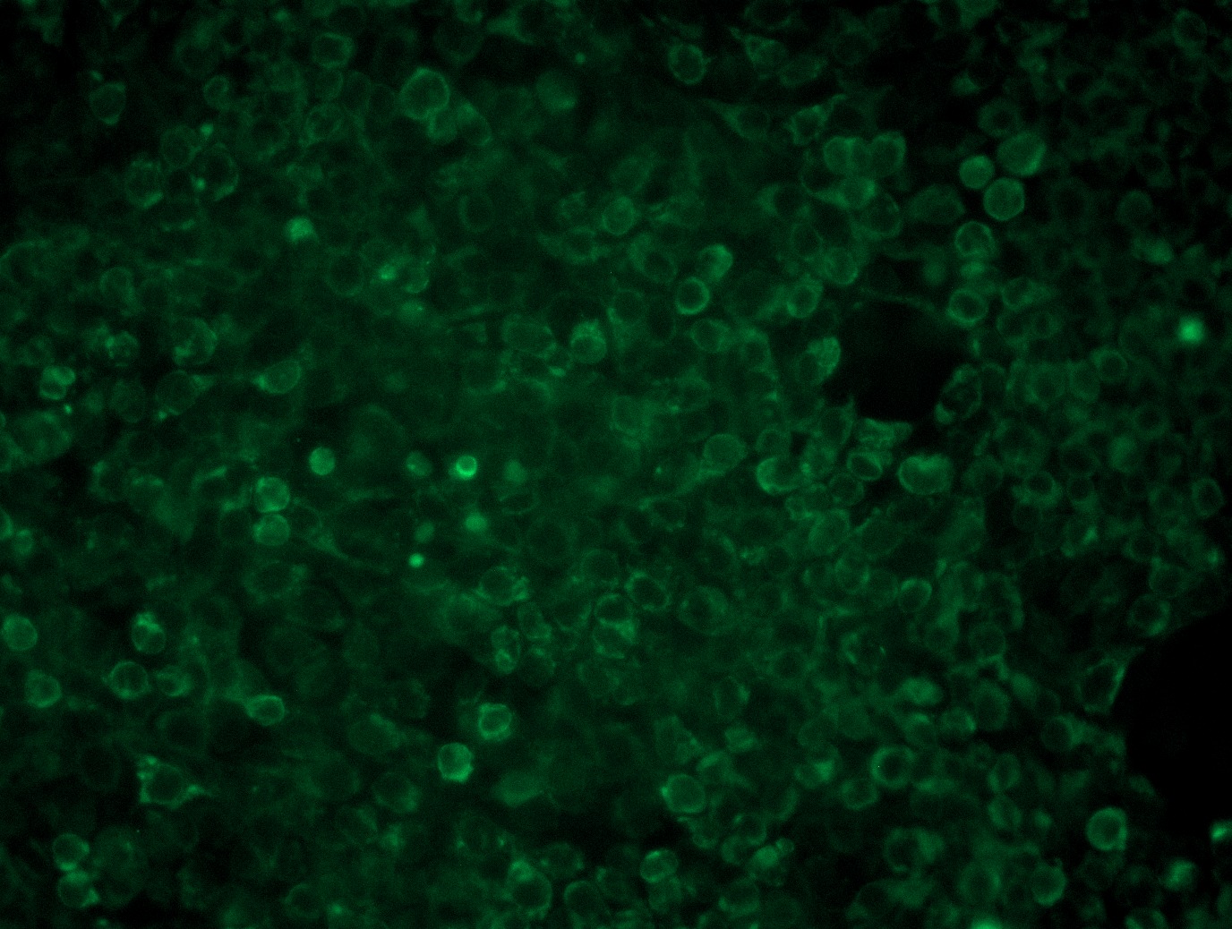 <a href = "https://www.origene.com/catalog/cdna-clones/expression-plasmids/rc217163l3-mfge8-nm-005928-human-tagged-lenti-orf-clone" title="RC217163L3" class="">RC217163L3</a> was used to prepare Lentiviral particles using <a href = "https://www.origene.com/catalog/others/lentiviral-packaging-kits/tr30037-lentiviral-packaging-kits" title="TR30037" class="">TR30037</a> packaging kit. HEK293T cells were transduced with RC217163L3V particle to overexpress human MFGE8-Myc-DDK fusion protein.