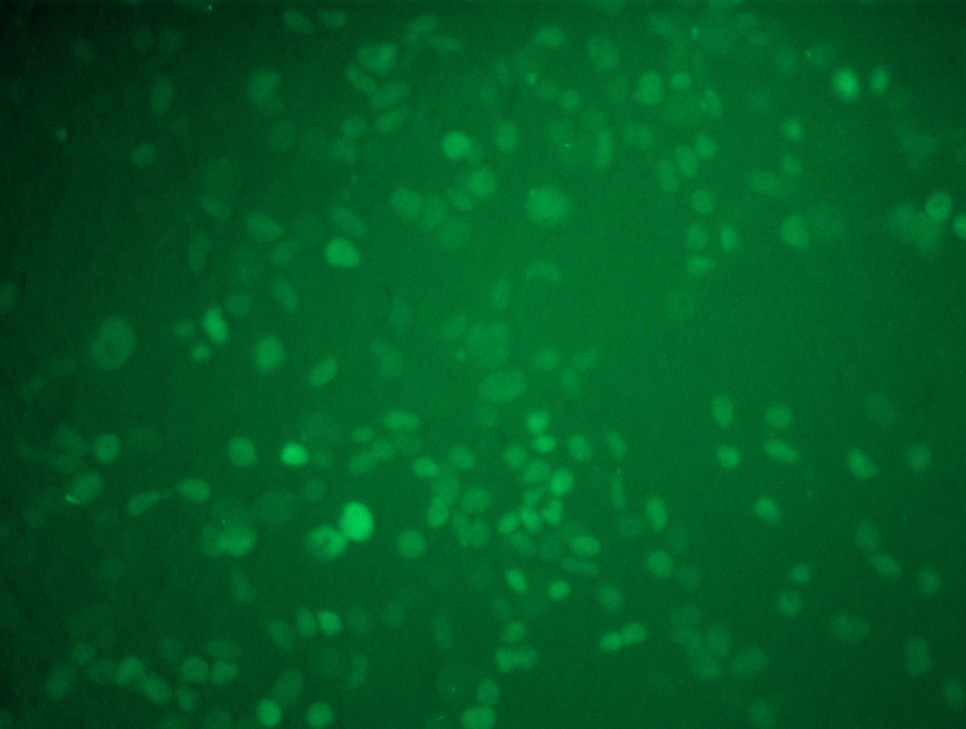 <a href = "https://www.origene.com/catalog/cdna-clones/expression-plasmids/rc217863l4-hnf-4-alpha-hnf4a-nm-000457-human-tagged-lenti-orf-clone" title="RC217863L4" class="">RC217863L4</a> was used to prepare Lentiviral particles using <a href = "https://www.origene.com/catalog/others/lentiviral-packaging-kits/tr30037-lentiviral-packaging-kits" title="TR30037" class="">TR30037</a> packaging kit. HEK293T cells were transduced with RC217863L4V particle to overexpress human HNF4A-mGFP fusion protein.