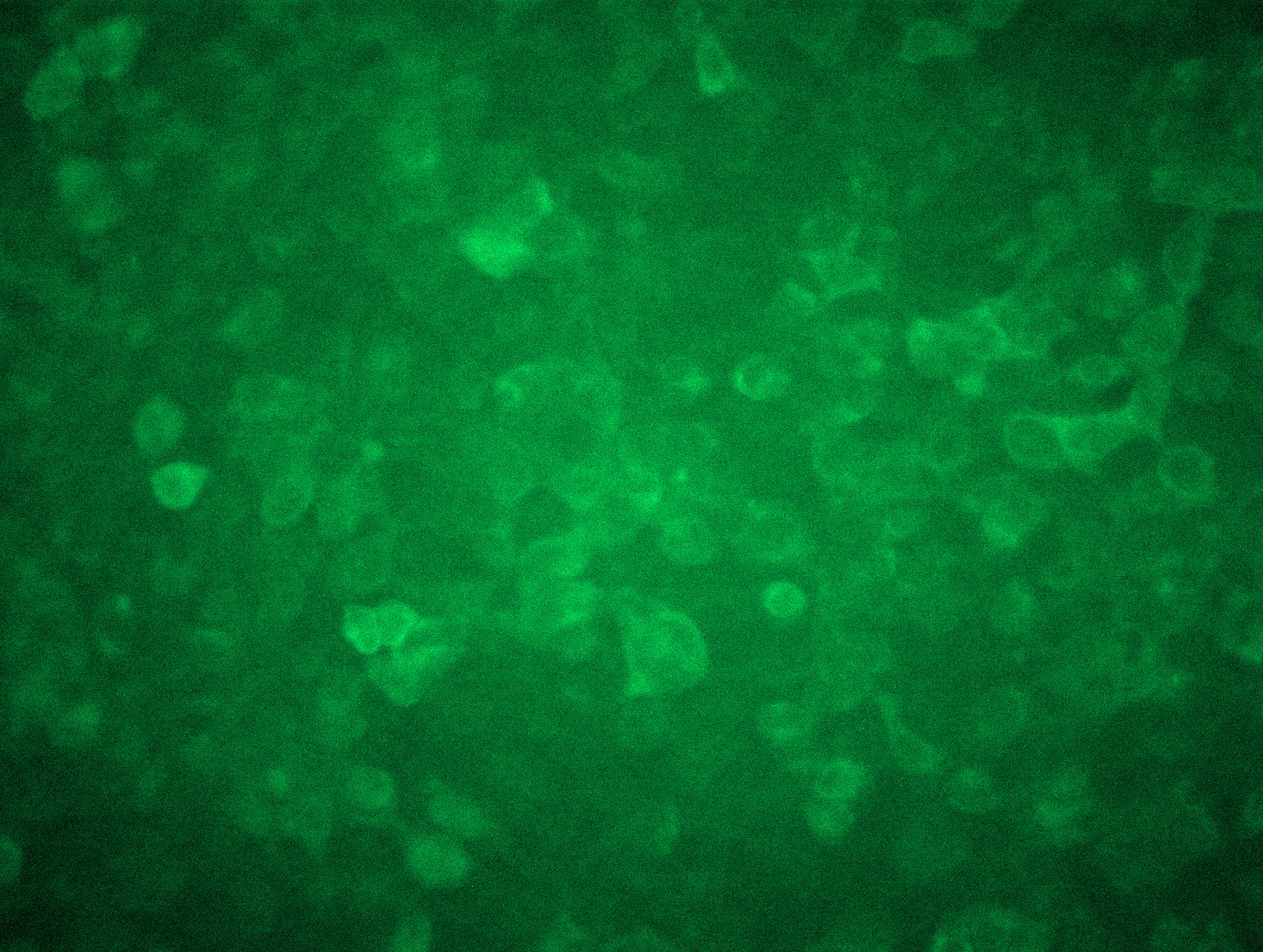 <a href = "https://www.origene.com/catalog/cdna-clones/expression-plasmids/rc218310l3-psma-folh1-nm-004476-human-tagged-lenti-orf-clone" title="RC218310L3" class="">RC218310L3</a> was used to prepare Lentiviral particles using <a href = "https://www.origene.com/catalog/others/lentiviral-packaging-kits/tr30037-lentiviral-packaging-kits" title="TR30037" class="">TR30037</a> packaging kit. HEK293T cells were transduced with RC218310L3V particle to overexpress human FOLH1-Myc-DDK fusion protein.