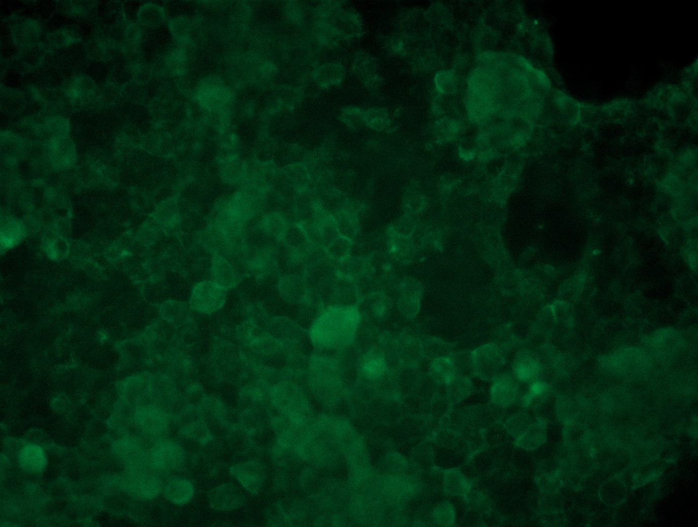 <a href = "https://www.origene.com/catalog/cdna-clones/expression-plasmids/rc219458l3-cd272-btla-nm-181780-human-tagged-lenti-orf-clone" title="RC219458L3" class="">RC219458L3</a> was used to prepare Lentiviral particles using <a href = "https://www.origene.com/catalog/others/lentiviral-packaging-kits/tr30037-lentiviral-packaging-kits" title="TR30037" class="">TR30037</a> packaging kit. HEK293T cells were transduced with RC219458L3V particle to overexpress human BTLA-Myc-DDK fusion protein.