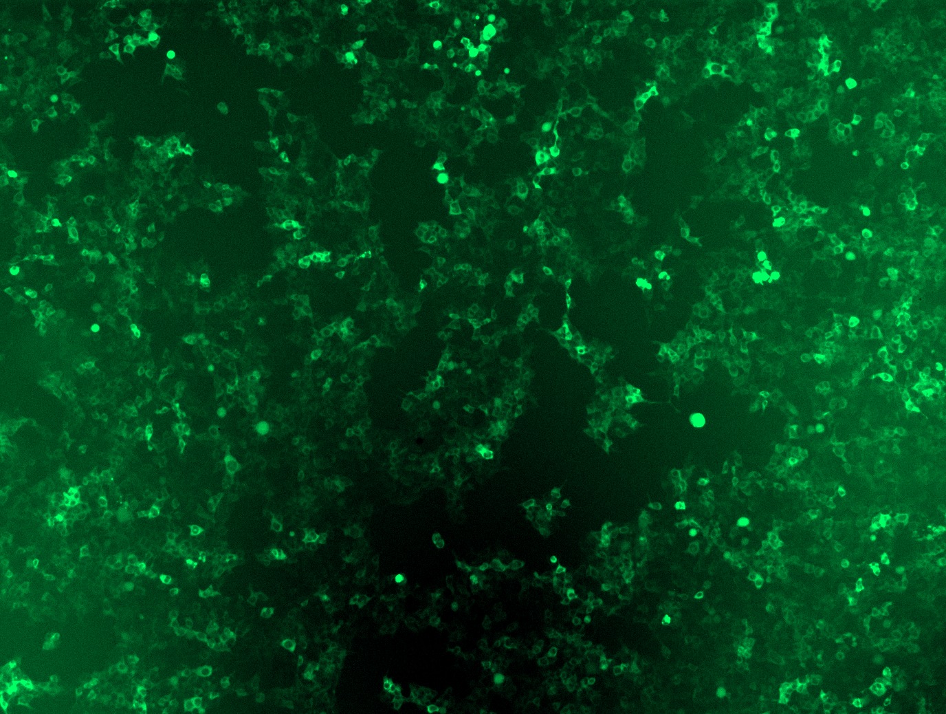 <a href = "https://www.origene.com/catalog/cdna-clones/expression-plasmids/rc221628l2-bach1-nm-206866-human-tagged-lenti-orf-clone" title="RC221628L2" class="">RC221628L2</a> was used to prepare Lentiviral particles using <a href = "https://www.origene.com/catalog/others/lentiviral-packaging-kits/tr30037-lentiviral-packaging-kits" title="TR30037" class="">TR30037</a> packaging kit. HEK293T cells were transduced with RC221628L2V particle to overexpress human BACH1-mGFP fusion protein.