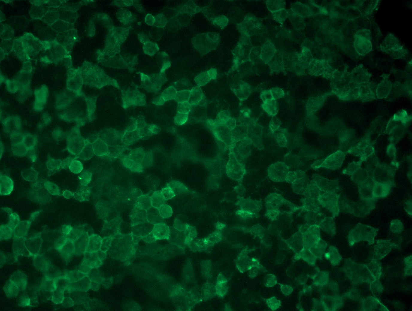 <a href = "https://www.origene.com/catalog/cdna-clones/expression-plasmids/rc221974l1-il12rb1-nm-005535-human-tagged-lenti-orf-clone" title="RC221974L1" class="">RC221974L1</a> was used to prepare Lentiviral particles using <a href = "https://www.origene.com/catalog/others/lentiviral-packaging-kits/tr30037-lentiviral-packaging-kits" title="TR30037" class="">TR30037</a> packaging kit. HEK293T cells were transduced with RC221974L1V particle to overexpress human IL12RB1-Myc-DDK fusion protein.