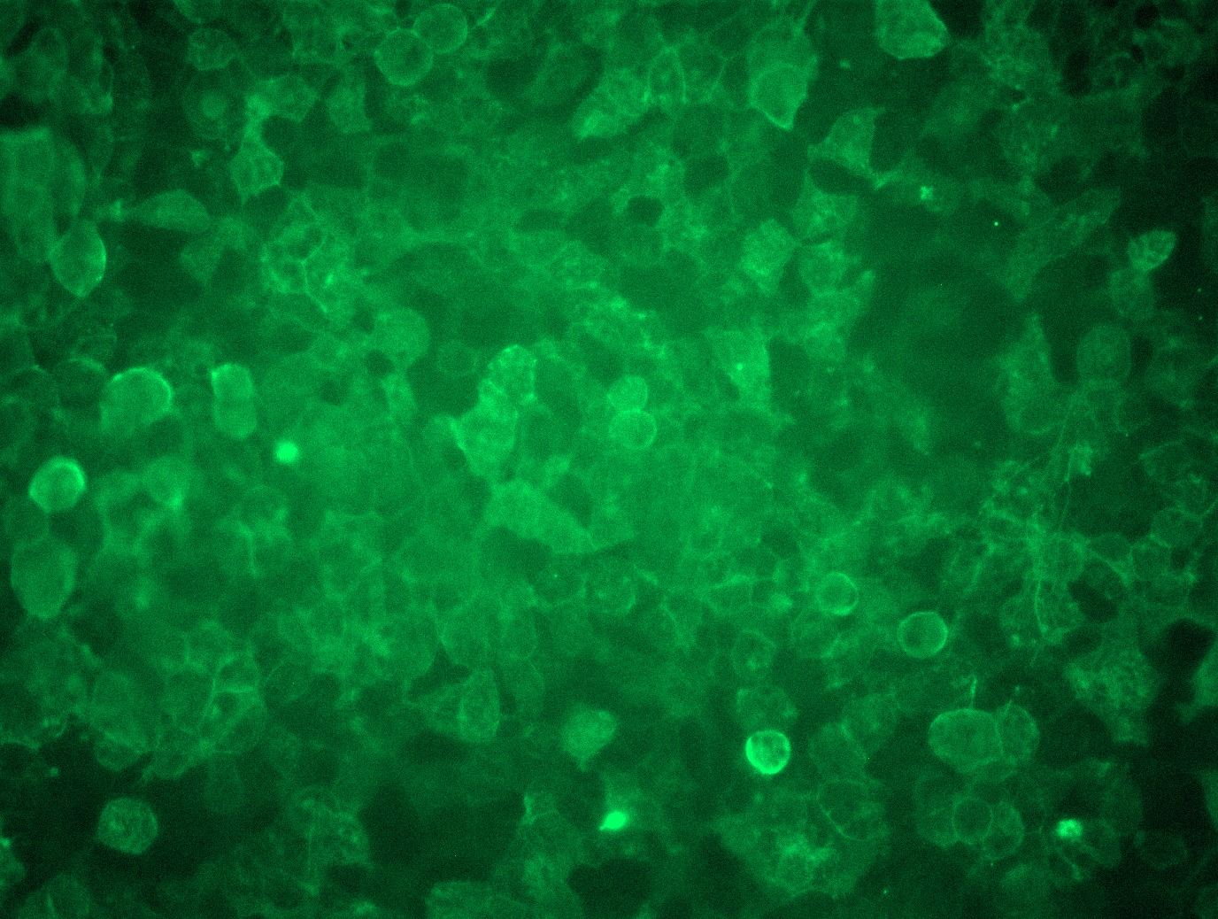 Nectin 3 (NECTIN3) (NM_015480) Human Tagged ORF Clone Lentiviral Particle
