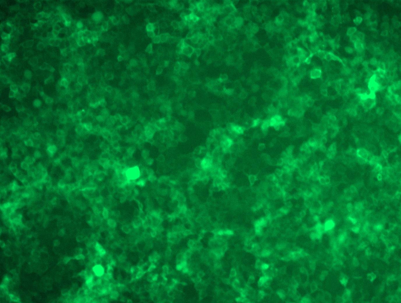 <a href = "https://www.origene.com/catalog/cdna-clones/expression-plasmids/rc223662l4-caspase-3-casp3-nm-004346-human-tagged-lenti-orf-clone" title="RC223662L4" class="">RC223662L4</a> was used to prepare Lentiviral particles using <a href = "https://www.origene.com/catalog/others/lentiviral-packaging-kits/tr30037-lentiviral-packaging-kits" title="TR30037" class="">TR30037</a> packaging kit. HEK293T cells were transduced with RC223662L4V particle to overexpress human CASP3-mGFP fusion protein.