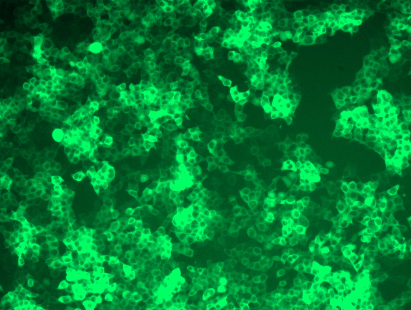 RC225648L4 was used to prepare Lentiviral particles using TR30037 packaging kit. HEK293T cells were transduced with RC225648L4V particle to overexpress human MAPT-mGFP fusion protein.