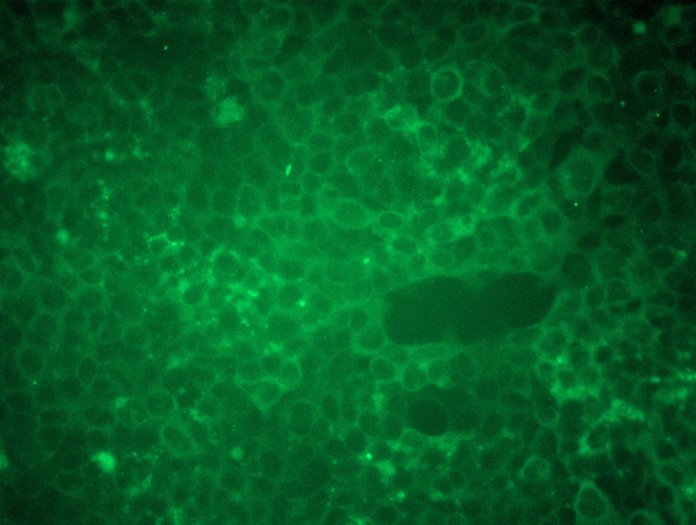 RC226001L3 was used to prepare Lentiviral particles using TR30037 packaging kit. HEK293T cells were transduced with RC226001L3V particle to overexpress human NF1-Myc-DDK fusion protein.