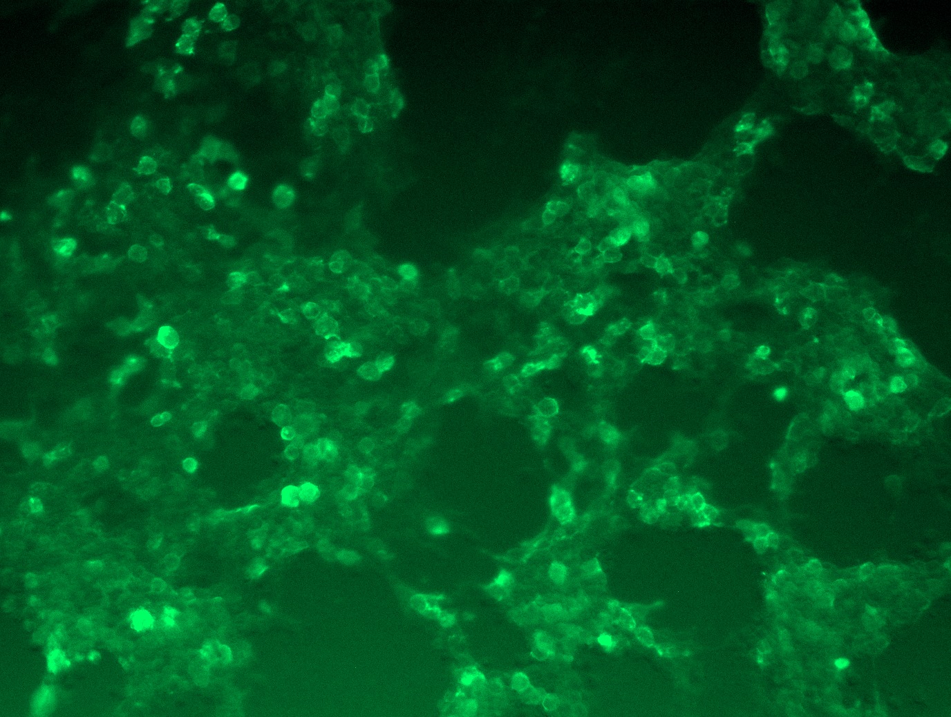 RC226390L3 was used to prepare Lentiviral particles using TR30037 packaging kit. HEK293T cells were transduced with RC226390L3V particle to overexpress human ROBO2-Myc-DDK fusion protein.