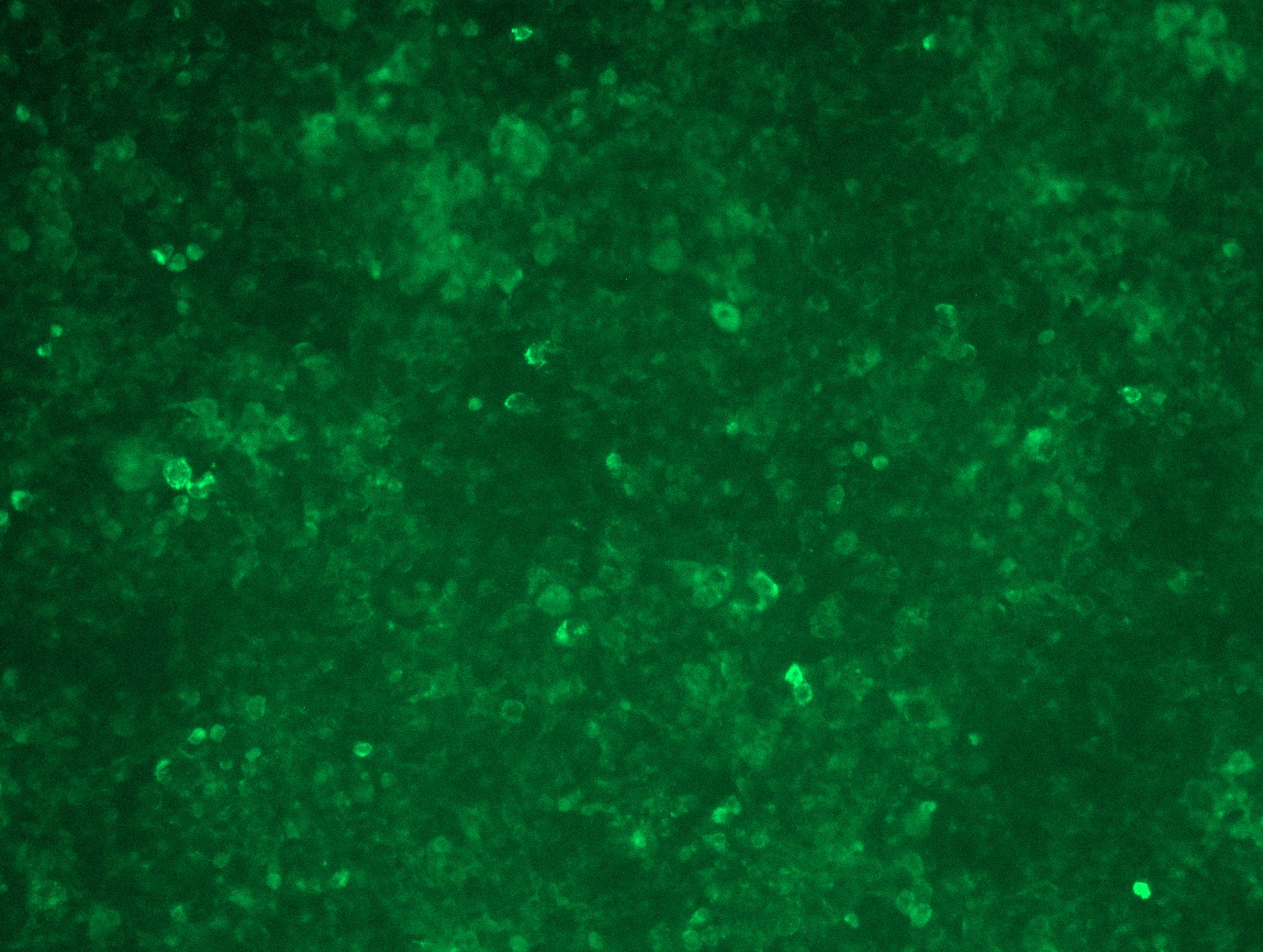 RC226571L3 was used to prepare Lentiviral particles using TR30037 packaging kit. HEK293T cells were transduced with RC226571L3V particle to overexpress human IL11RA-Myc-DDK fusion protein.