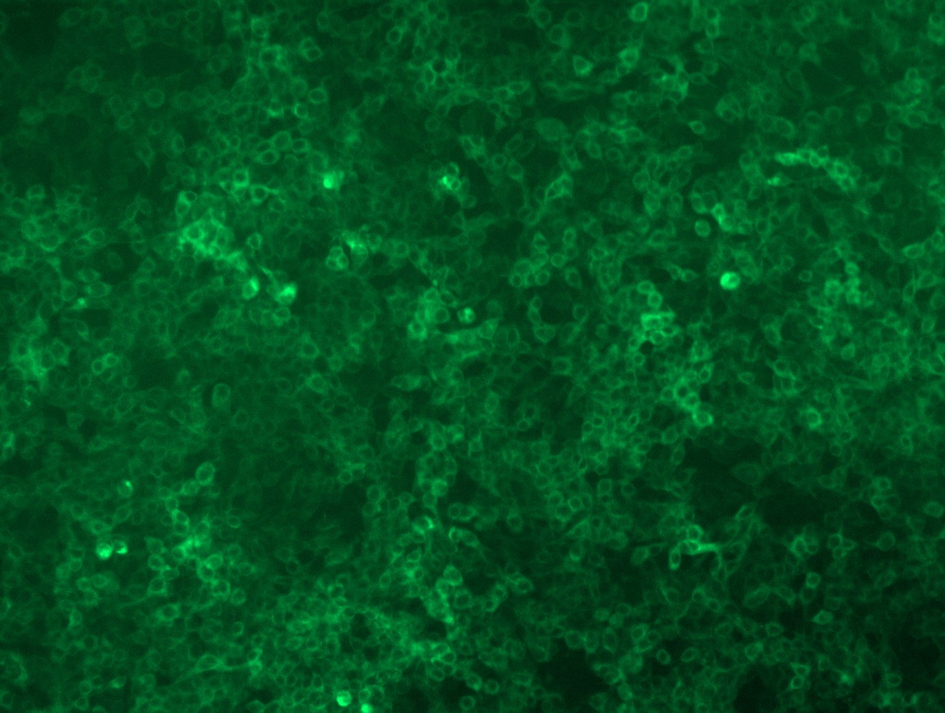 RC227329L2 was used to prepare Lentiviral particles using TR30037 packaging kit. HEK293T cells were transduced with RC227329L2V particle to overexpress human FCGRT-mGFP fusion protein.