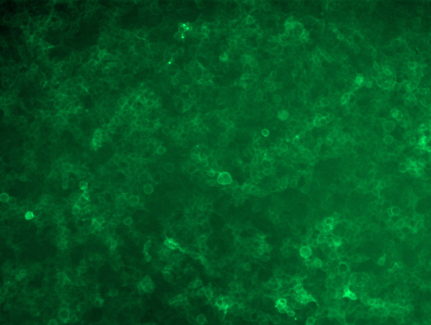 RC230267L4 was used to prepare Lentiviral particles using TR30037 packaging kit. HEK293T cells were transduced with RC230267L4V particle to overexpress human CD19-mGFP fusion protein.