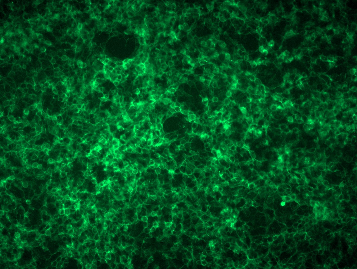 <a href = "https://www.origene.com/catalog/cdna-clones/expression-plasmids/mr208266l4-nectin1-nm-021424-mouse-tagged-lenti-orf-clone" title="MR208266L4" class="">MR208266L4</a> was used to prepare Lentiviral particles using <a href = "https://www.origene.com/catalog/others/lentiviral-packaging-kits/tr30037-lentiviral-packaging-kits" title="TR30037" class="">TR30037</a> packaging kit. HEK293T cells were transduced with MR208266L4V particle to overexpress human Nectin1-mGFP fusion protein.
