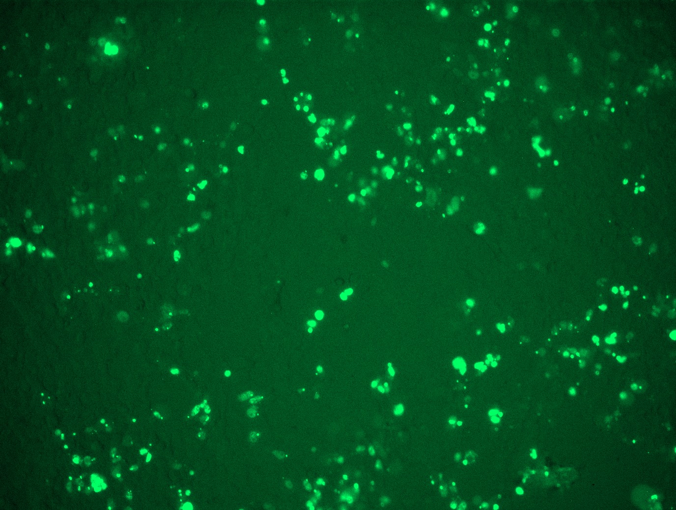 <a href = "https://www.origene.com/catalog/cdna-clones/expression-plasmids/rc200003l2-p53-tp53-nm-000546-human-tagged-lenti-orf-clone" title="RC200003L2" class="">RC200003L2</a> was used to prepare Lentiviral particles using <a href = "https://www.origene.com/catalog/others/lentiviral-packaging-kits/tr30037-lentiviral-packaging-kits" title="TR30037" class="">TR30037</a> packaging kit. HEK293T cells were transduced with RC200003L2V particle to overexpress human TP53-mGFP fusion protein.