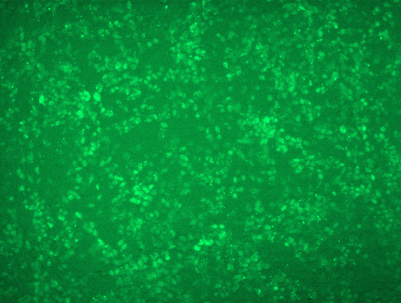 RC200003L4 was used to prepare Lentiviral particles using TR30037 packaging kit. HEK293T cells were transduced with RC200003L4V particle to overexpress human TP53-mGFP fusion protein.