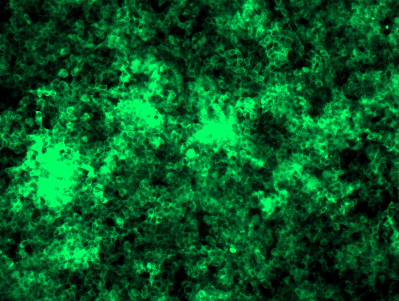 <a href = "https://www.origene.com/catalog/cdna-clones/expression-plasmids/rc200310l2-stub1-nm-005861-human-tagged-lenti-orf-clone" title="RC200310L2" class="">RC200310L2</a> was used to prepare Lentiviral particles using <a href = "https://www.origene.com/catalog/others/lentiviral-packaging-kits/tr30037-lentiviral-packaging-kits" title="TR30037" class="">TR30037</a> packaging kit. HEK293T cells were transduced with RC200310L2V particle to overexpress human STUB1-mGFP fusion protein.