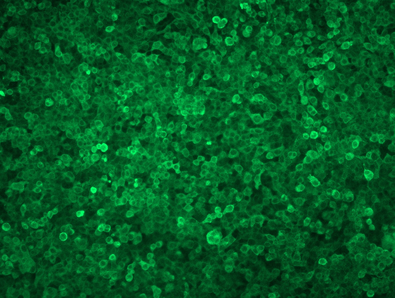<a href = "https://www.origene.com/catalog/cdna-clones/expression-plasmids/rc200463l1-heme-oxygenase-1-hmox1-nm-002133-human-tagged-lenti-orf-clone" title="RC200463L1" class="">RC200463L1</a> was used to prepare Lentiviral particles using <a href = "https://www.origene.com/catalog/others/lentiviral-packaging-kits/tr30037-lentiviral-packaging-kits" title="TR30037" class="">TR30037</a> packaging kit. HEK293T cells were transduced with RC200463L1V particle to overexpress human HMOX1-Myc-DDK fusion protein.