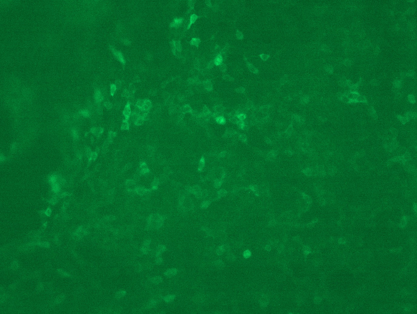 <a href = "https://www.origene.com/catalog/cdna-clones/expression-plasmids/rc200521l1-mcl1-nm-021960-human-tagged-lenti-orf-clone" title="RC200521L1" class="">RC200521L1</a> was used to prepare Lentiviral particles using <a href = "https://www.origene.com/catalog/others/lentiviral-packaging-kits/tr30037-lentiviral-packaging-kits" title="TR30037" class="">TR30037</a> packaging kit. HEK293T cells were transduced with RC200521L1V particle to overexpress human MCL1-Myc-DDK fusion protein.