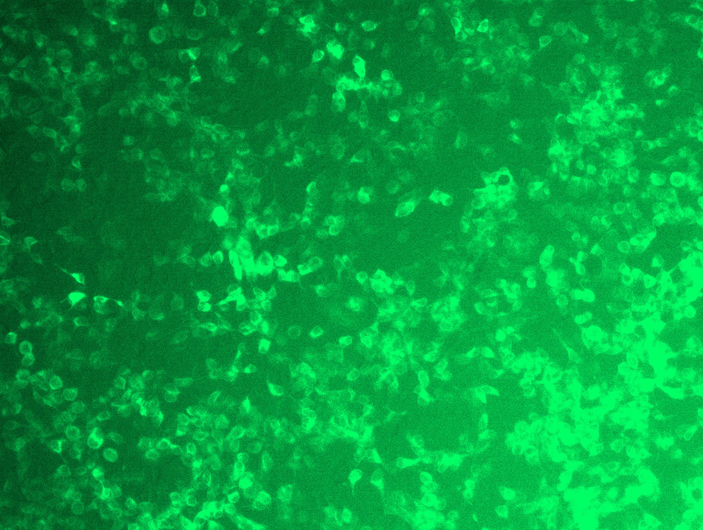 <a href = "https://www.origene.com/catalog/cdna-clones/expression-plasmids/rc200661l4-hlaa-hla-a-nm-002116-human-tagged-lenti-orf-clone" title="RC200661L4" class="">RC200661L4</a> was used to prepare Lentiviral particles using <a href = "https://www.origene.com/catalog/others/lentiviral-packaging-kits/tr30037-lentiviral-packaging-kits" title="TR30037" class="">TR30037</a> packaging kit. HEK293T cells were transduced with RC200661L4V particle to overexpress human HLA-A-mGFP fusion protein.