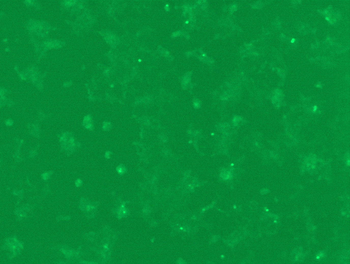 <a href = "https://www.origene.com/catalog/cdna-clones/expression-plasmids/rc200739l4-p21-ras-hras-nm-176795-human-tagged-lenti-orf-clone" title="RC200739L4" class="">RC200739L4</a> was used to prepare Lentiviral particles using <a href = "https://www.origene.com/catalog/others/lentiviral-packaging-kits/tr30037-lentiviral-packaging-kits" title="TR30037" class="">TR30037</a> packaging kit. HEK293T cells were transduced with RC200739L4V particle to overexpress human HRAS-mGFP fusion protein.