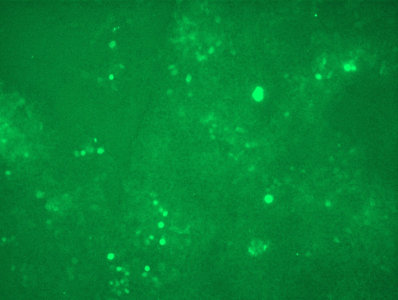 <a href = "https://www.origene.com/catalog/cdna-clones/expression-plasmids/rc201611l3-c-myc-myc-nm-002467-human-tagged-lenti-orf-clone" title="RC201611L3" class="">RC201611L3</a> was used to prepare Lentiviral particles using <a href = "https://www.origene.com/catalog/others/lentiviral-packaging-kits/tr30037-lentiviral-packaging-kits" title="TR30037" class="">TR30037</a> packaging kit. HEK293T cells were transduced with RC201611L3V particle to overexpress human MYC-Myc-DDK fusion protein.