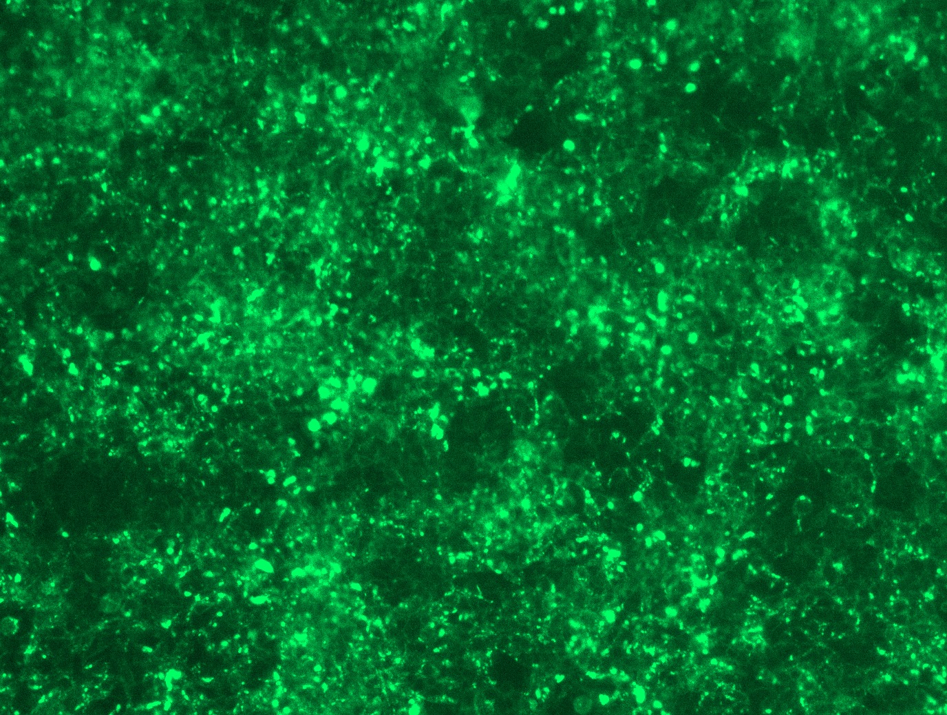 <a href = "https://www.origene.com/catalog/cdna-clones/expression-plasmids/rc201990l2-lamin-b-receptor-lbr-nm-002296-human-tagged-lenti-orf-clone" title="RC201990L2" class="">RC201990L2</a> was used to prepare Lentiviral particles using <a href = "https://www.origene.com/catalog/others/lentiviral-packaging-kits/tr30037-lentiviral-packaging-kits" title="TR30037" class="">TR30037</a> packaging kit. HEK293T cells were transduced with RC201990L2V particle to overexpress human LBR-mGFP fusion protein.
