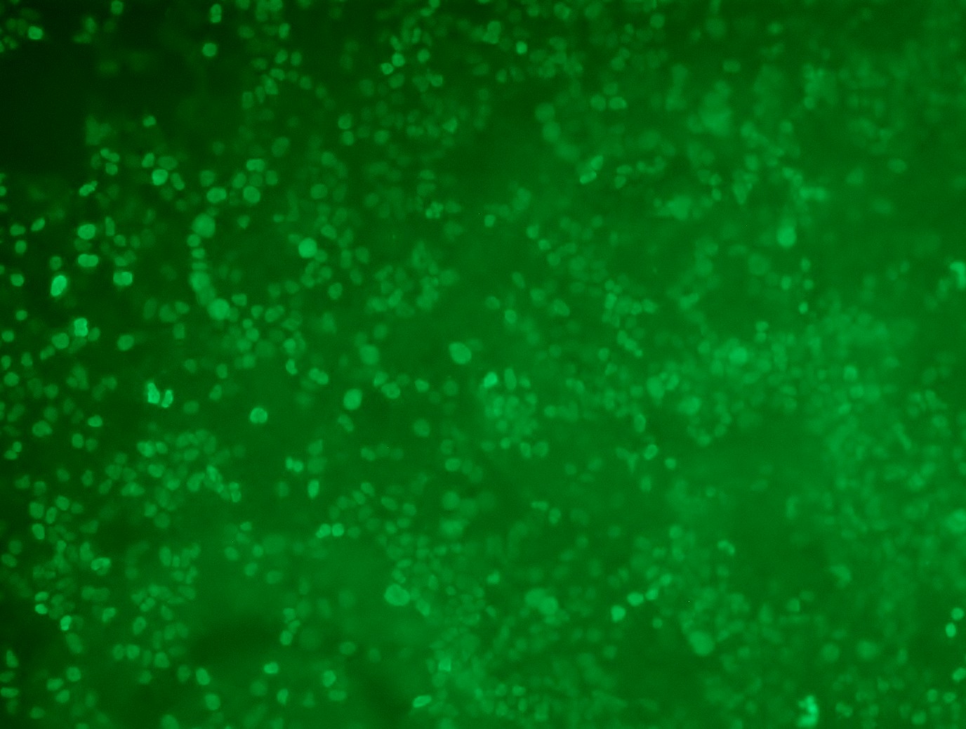 <a href = "https://www.origene.com/catalog/cdna-clones/expression-plasmids/rc202920l3-twist-twist1-nm-000474-human-tagged-lenti-orf-clone" title="RC202920L3" class="">RC202920L3</a> was used to prepare Lentiviral particles using <a href = "https://www.origene.com/catalog/others/lentiviral-packaging-kits/tr30037-lentiviral-packaging-kits" title="TR30037" class="">TR30037</a> packaging kit. HEK293T cells were transduced with RC202920L3V particle to overexpress human TWIST1-Myc-DDK fusion protein.