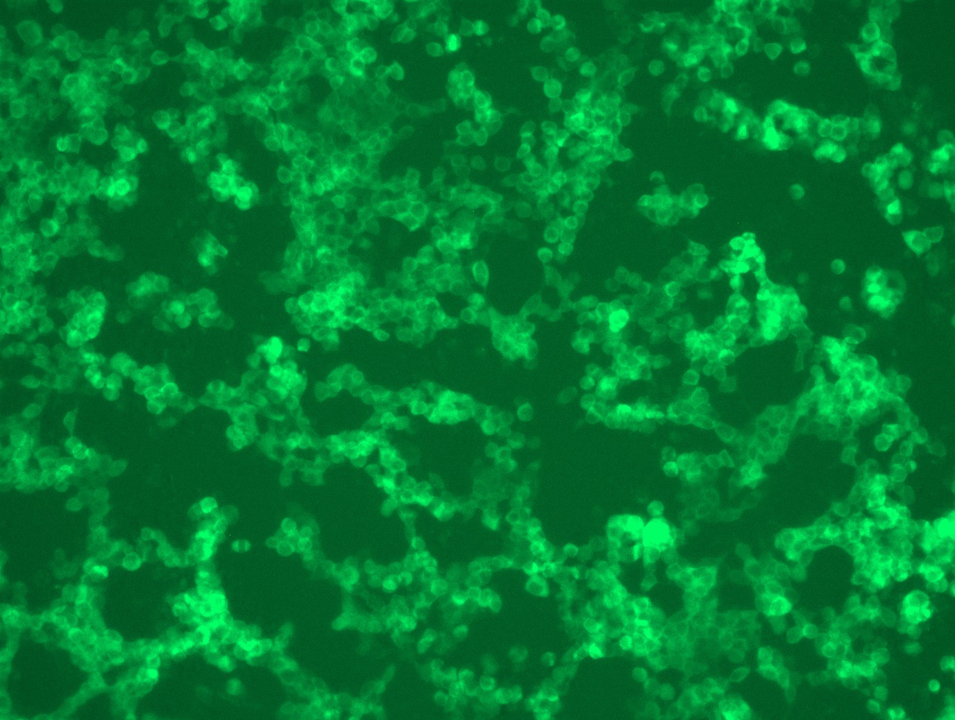 <a href = "https://www.origene.com/catalog/cdna-clones/expression-plasmids/rc202930l4-dgka-nm-201444-human-tagged-lenti-orf-clone" title="RC202930L4" class="">RC202930L4</a> was used to prepare Lentiviral particles using <a href = "https://www.origene.com/catalog/others/lentiviral-packaging-kits/tr30037-lentiviral-packaging-kits" title="TR30037" class="">TR30037</a> packaging kit. HEK293T cells were transduced with RC202930L4V particle to overexpress human DGKA-mGFP fusion protein.