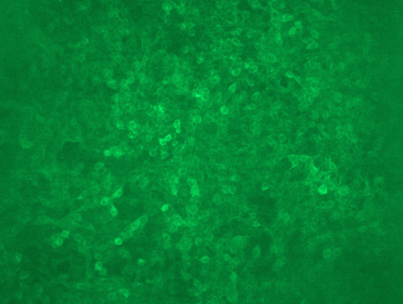 <a href = "https://www.origene.com/catalog/cdna-clones/expression-plasmids/rc203321l1-fc-epsilon-ri-fcer1a-nm-002001-human-tagged-lenti-orf-clone" title="RC203321L1" class="">RC203321L1</a> was used to prepare Lentiviral particles using <a href = "https://www.origene.com/catalog/others/lentiviral-packaging-kits/tr30037-lentiviral-packaging-kits" title="TR30037" class="">TR30037</a> packaging kit. HEK293T cells were transduced with RC203321L1V particle to overexpress human FCER1A-Myc-DDK fusion protein.
