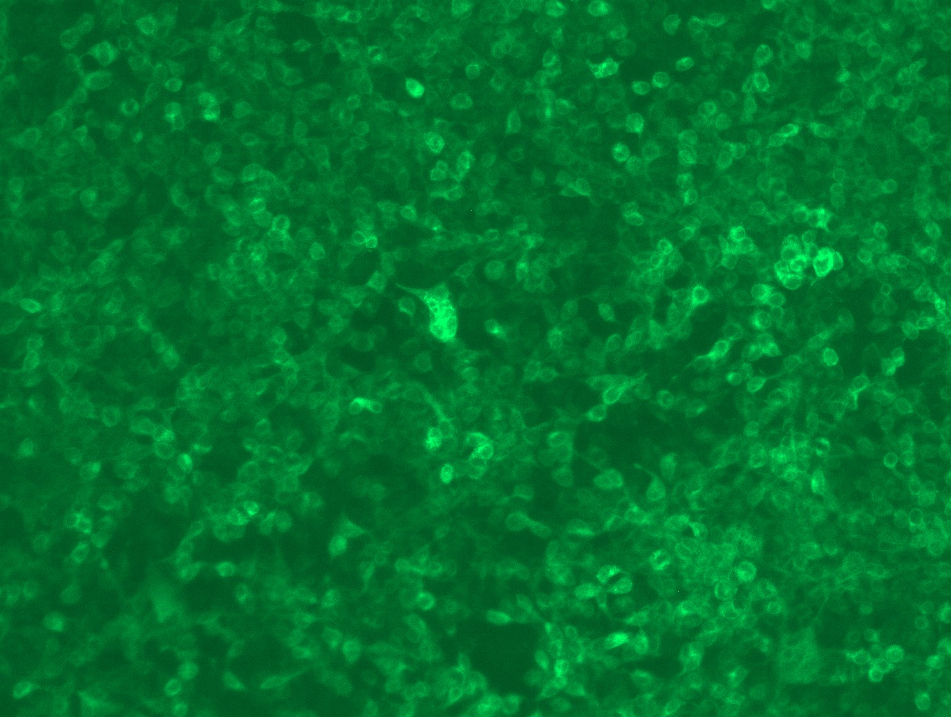 <a href = "https://www.origene.com/catalog/cdna-clones/expression-plasmids/rc203321l3-fc-epsilon-ri-fcer1a-nm-002001-human-tagged-lenti-orf-clone" title="RC203321L3" class="">RC203321L3</a> was used to prepare Lentiviral particles using <a href = "https://www.origene.com/catalog/others/lentiviral-packaging-kits/tr30037-lentiviral-packaging-kits" title="TR30037" class="">TR30037</a> packaging kit. HEK293T cells were transduced with RC203321L3V particle to overexpress human FCER1A-Myc-DDK fusion protein.