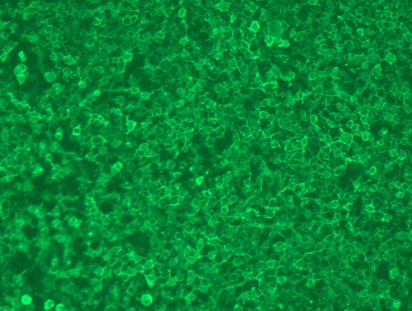 PVRL4 (NECTIN4) (NM_030916) Human Tagged ORF Clone Lentiviral Particle