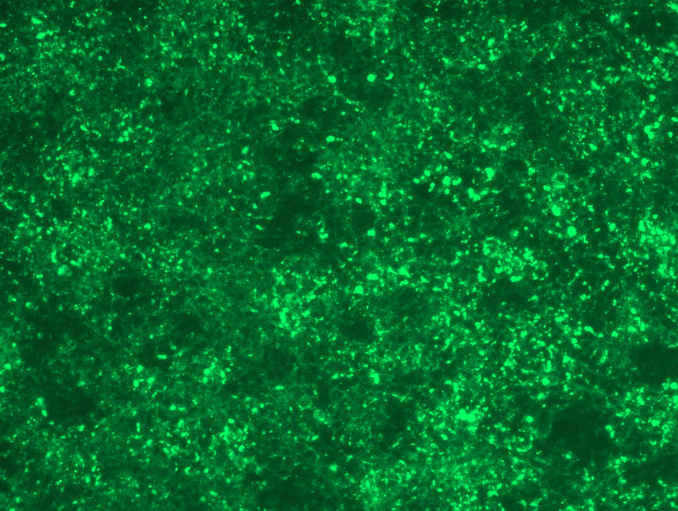 <a href = "https://www.origene.com/catalog/cdna-clones/expression-plasmids/rc204199l4-claudin-2-cldn2-nm-020384-human-tagged-lenti-orf-clone" title="RC204199L4" class="">RC204199L4</a> was used to prepare Lentiviral particles using <a href = "https://www.origene.com/catalog/others/lentiviral-packaging-kits/tr30037-lentiviral-packaging-kits" title="TR30037" class="">TR30037</a> packaging kit. HEK293T cells were transduced with RC204199L4V particle to overexpress human CLDN2-mGFP fusion protein.