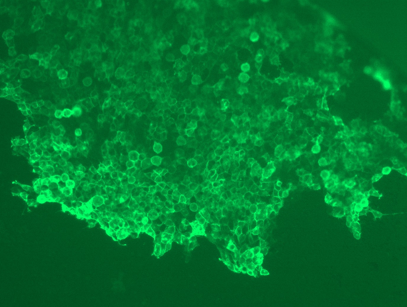 <a href = "https://www.origene.com/catalog/cdna-clones/expression-plasmids/rc204557l1-flrt1-nm-013280-human-tagged-lenti-orf-clone" title="RC204557L1" class="">RC204557L1</a> was used to prepare Lentiviral particles using <a href = "https://www.origene.com/catalog/others/lentiviral-packaging-kits/tr30037-lentiviral-packaging-kits" title="TR30037" class="">TR30037</a> packaging kit. HEK293T cells were transduced with RC204557L1V particle to overexpress human FLRT1-Myc-DDK fusion protein.