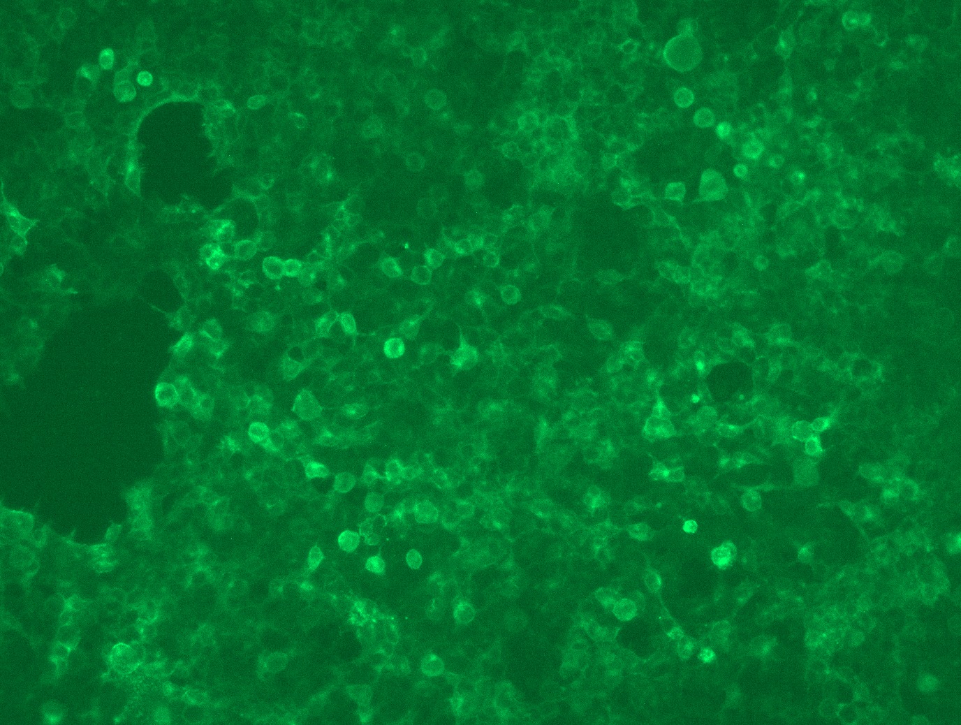 MS4A4A (NM_148975) Human Tagged ORF Clone Lentiviral Particle