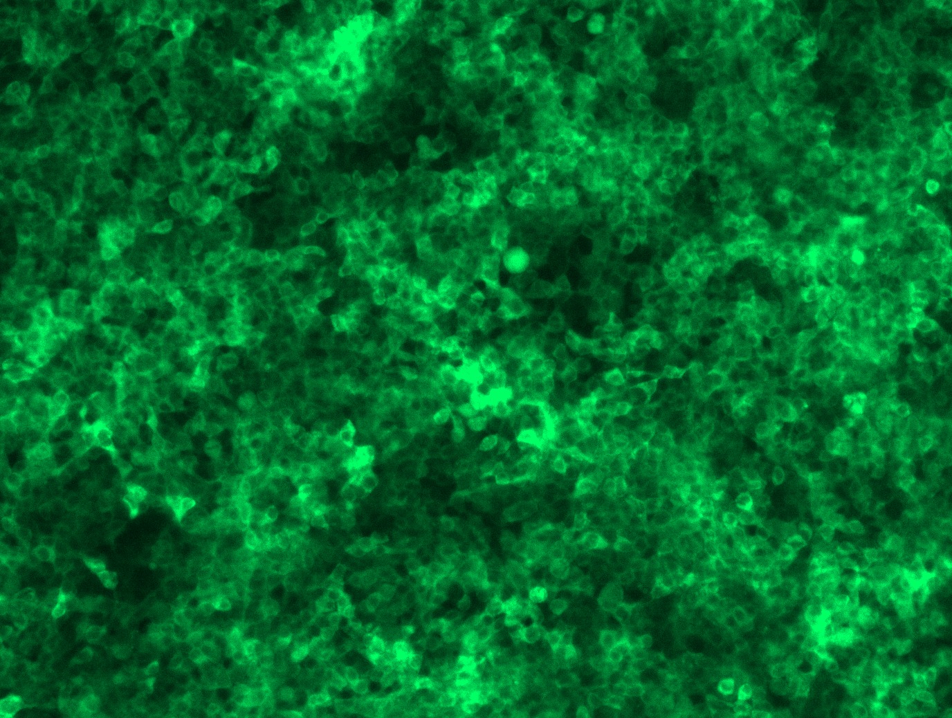 RC206024L4 was used to prepare Lentiviral particles using TR30037 packaging kit. HEK293T cells were transduced with RC206024L4V particle to overexpress human MTAP-mGFP fusion protein.