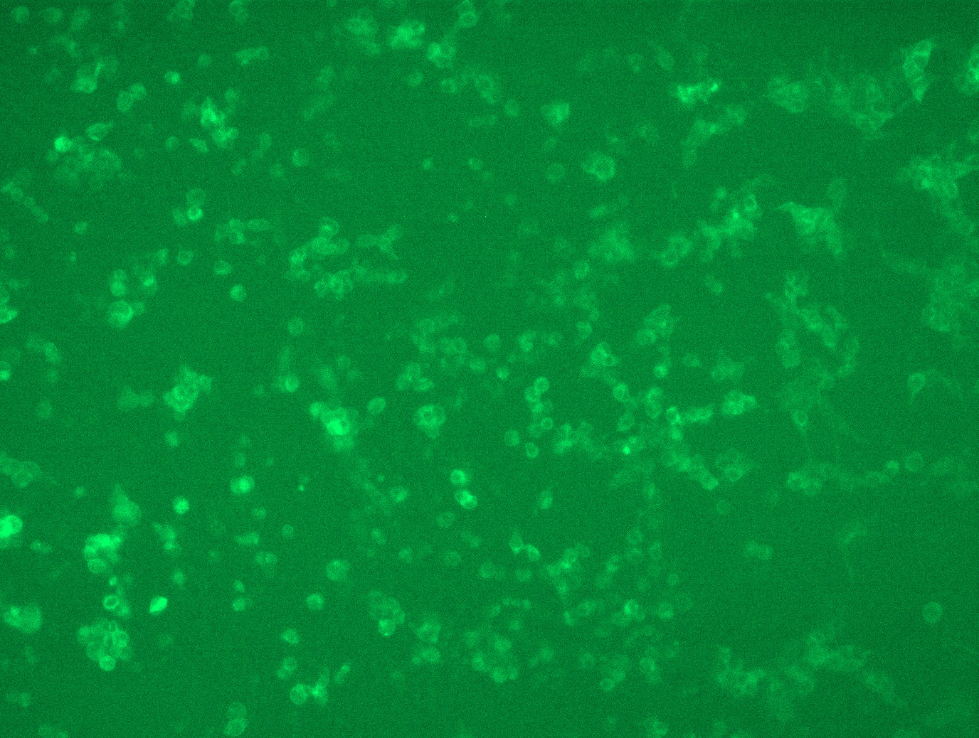 <a href = "https://www.origene.com/catalog/cdna-clones/expression-plasmids/rc207672l4-il13-receptor-alpha-2-il13ra2-nm-000640-human-tagged-lenti-orf-clone" title="RC207672L4" class="">RC207672L4</a> was used to prepare Lentiviral particles using <a href = "https://www.origene.com/catalog/others/lentiviral-packaging-kits/tr30037-lentiviral-packaging-kits" title="TR30037" class="">TR30037</a> packaging kit. HEK293T cells were transduced with RC207672L4V particle to overexpress human IL13RA2-mGFP fusion protein.