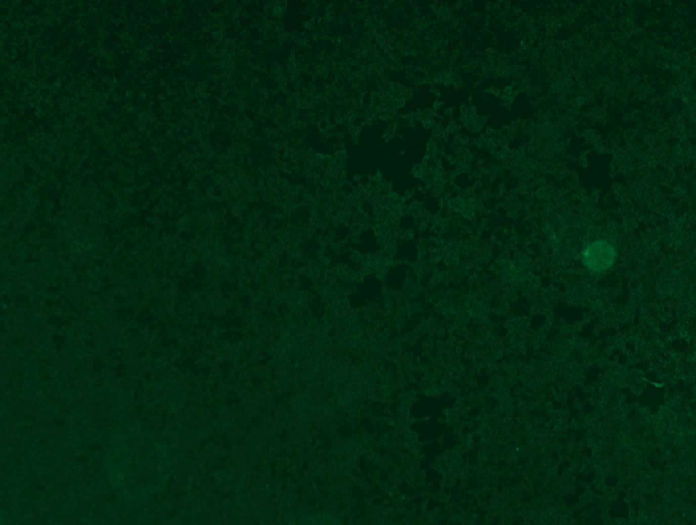 RC207691L3 was used to prepare Lentiviral particles using TR30037 packaging kit. HEK293T cells were transduced with RC207691L3V particle to overexpress human WNT7B-Myc-DDK fusion protein.