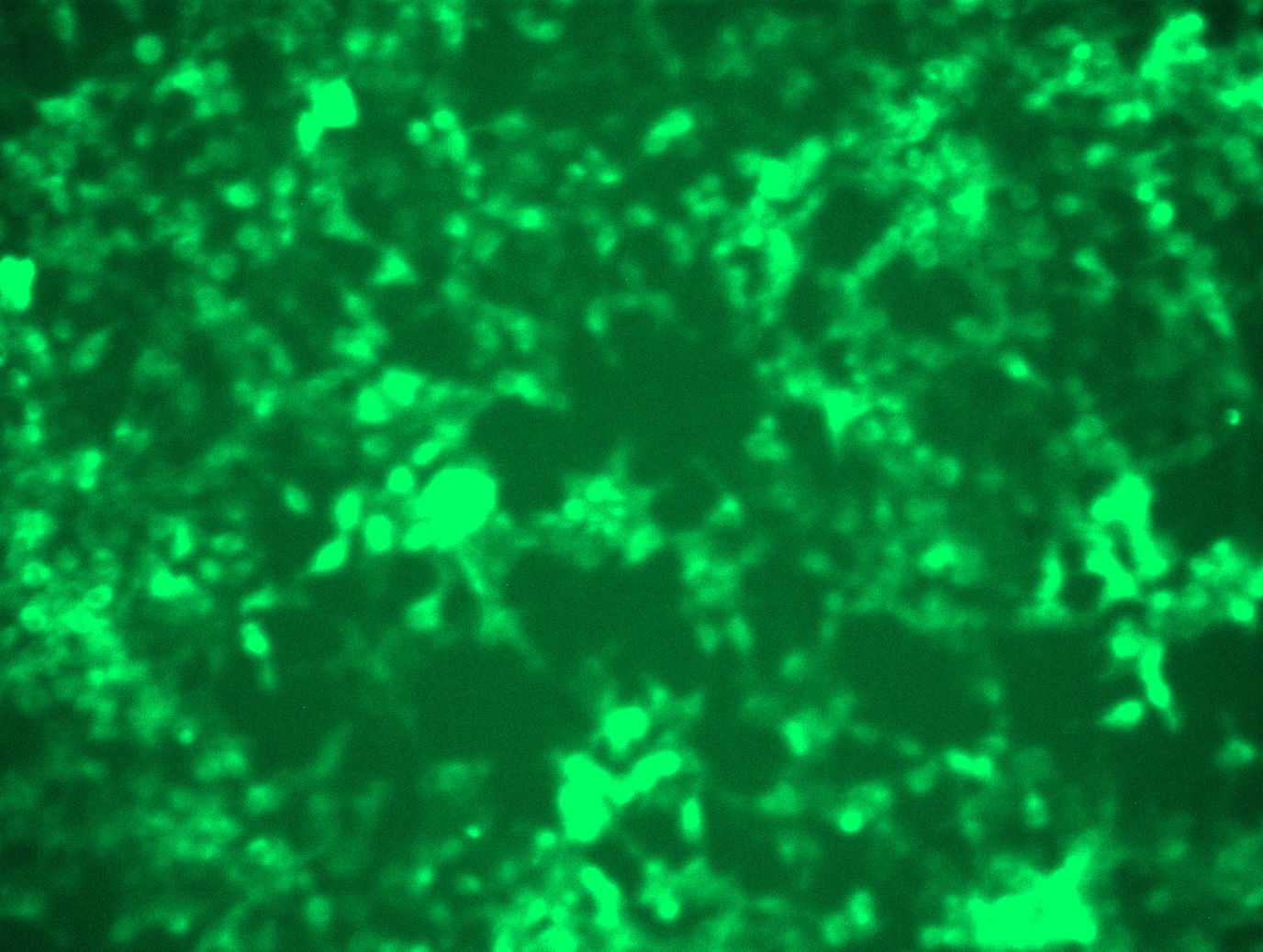 <a href = "https://www.origene.com/catalog/cdna-clones/expression-plasmids/rc208276l4-cd3e-nm-000733-human-tagged-lenti-orf-clone" title="RC208276L4" class="">RC208276L4</a> was used to prepare Lentiviral particles using <a href = "https://www.origene.com/catalog/others/lentiviral-packaging-kits/tr30037-lentiviral-packaging-kits" title="TR30037" class="">TR30037</a> packaging kit. HEK293T cells were transduced with RC208276L4V particle to overexpress human CD3E-mGFP fusion protein.