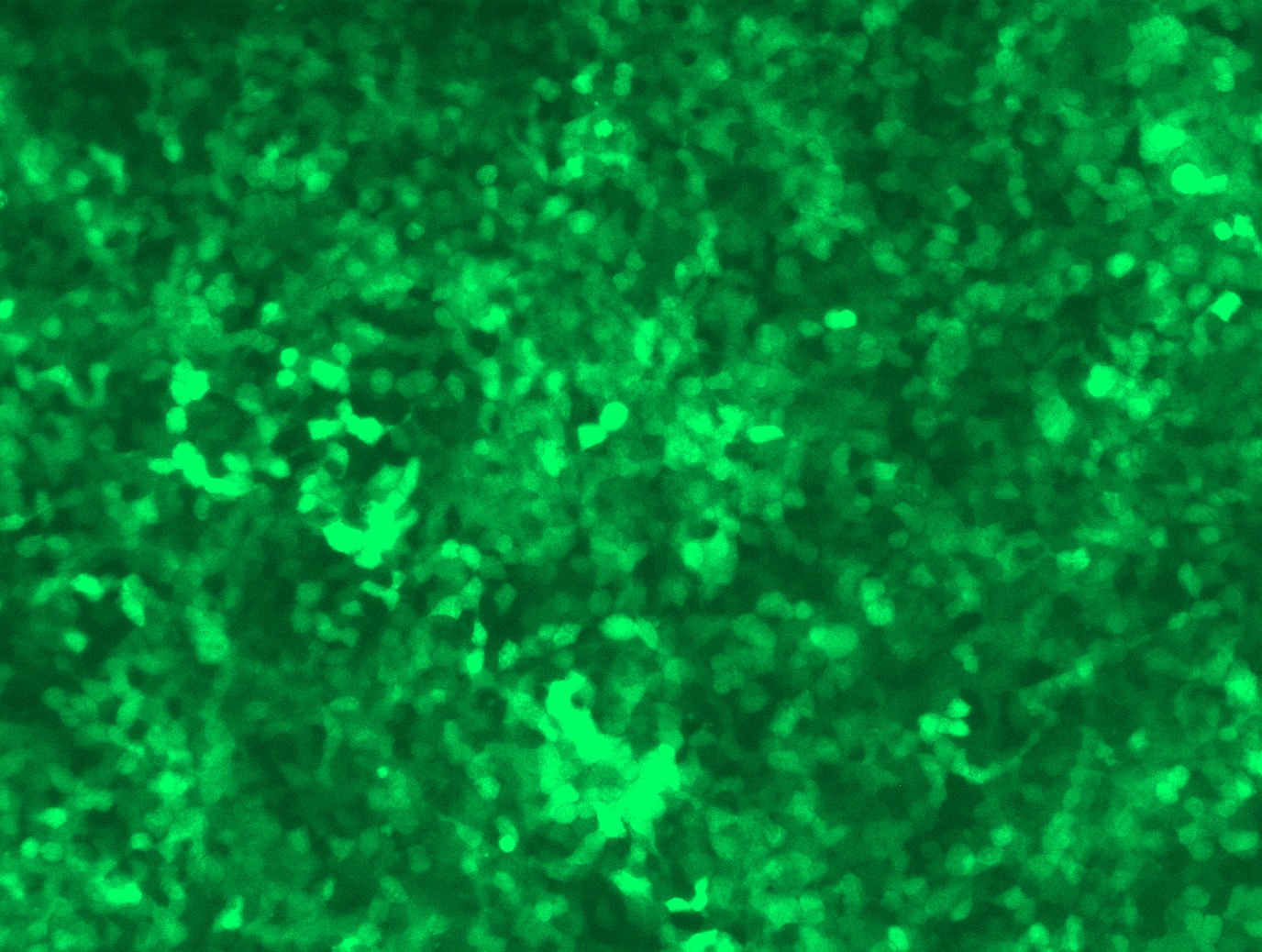 <a href = "https://www.origene.com/catalog/cdna-clones/expression-plasmids/rc208390l2-hdac8-nm-018486-human-tagged-lenti-orf-clone" title="RC208390L2" class="">RC208390L2</a> was used to prepare Lentiviral particles using <a href = "https://www.origene.com/catalog/others/lentiviral-packaging-kits/tr30037-lentiviral-packaging-kits" title="TR30037" class="">TR30037</a> packaging kit. HEK293T cells were transduced with RC208390L2V particle to overexpress human HDAC8-mGFP fusion protein.