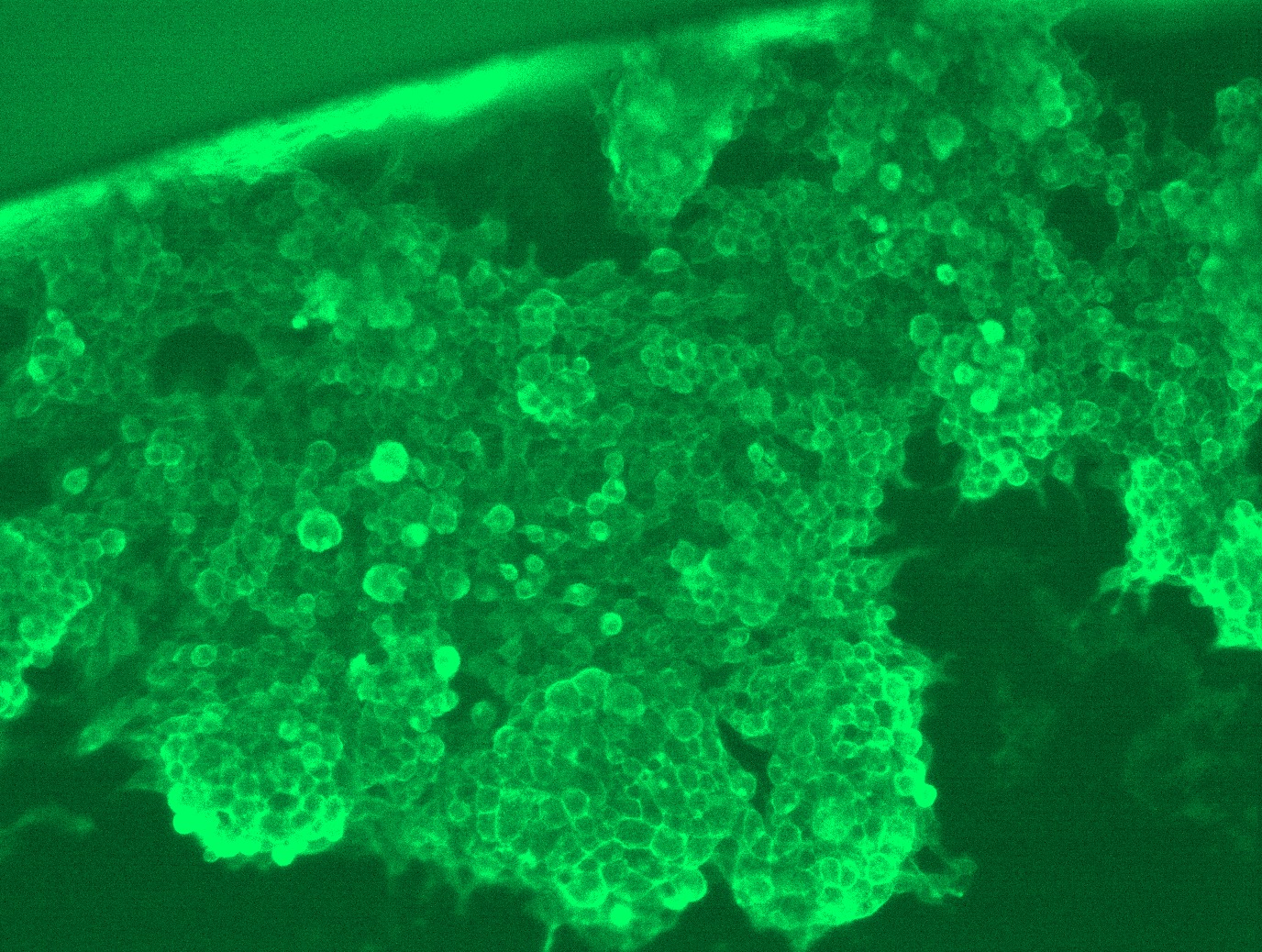 RC208442L1 was used to prepare Lentiviral particles using TR30037 packaging kit. HEK293T cells were transduced with RC208442L1V particle to overexpress human ACE2-Myc-DDK fusion protein.
