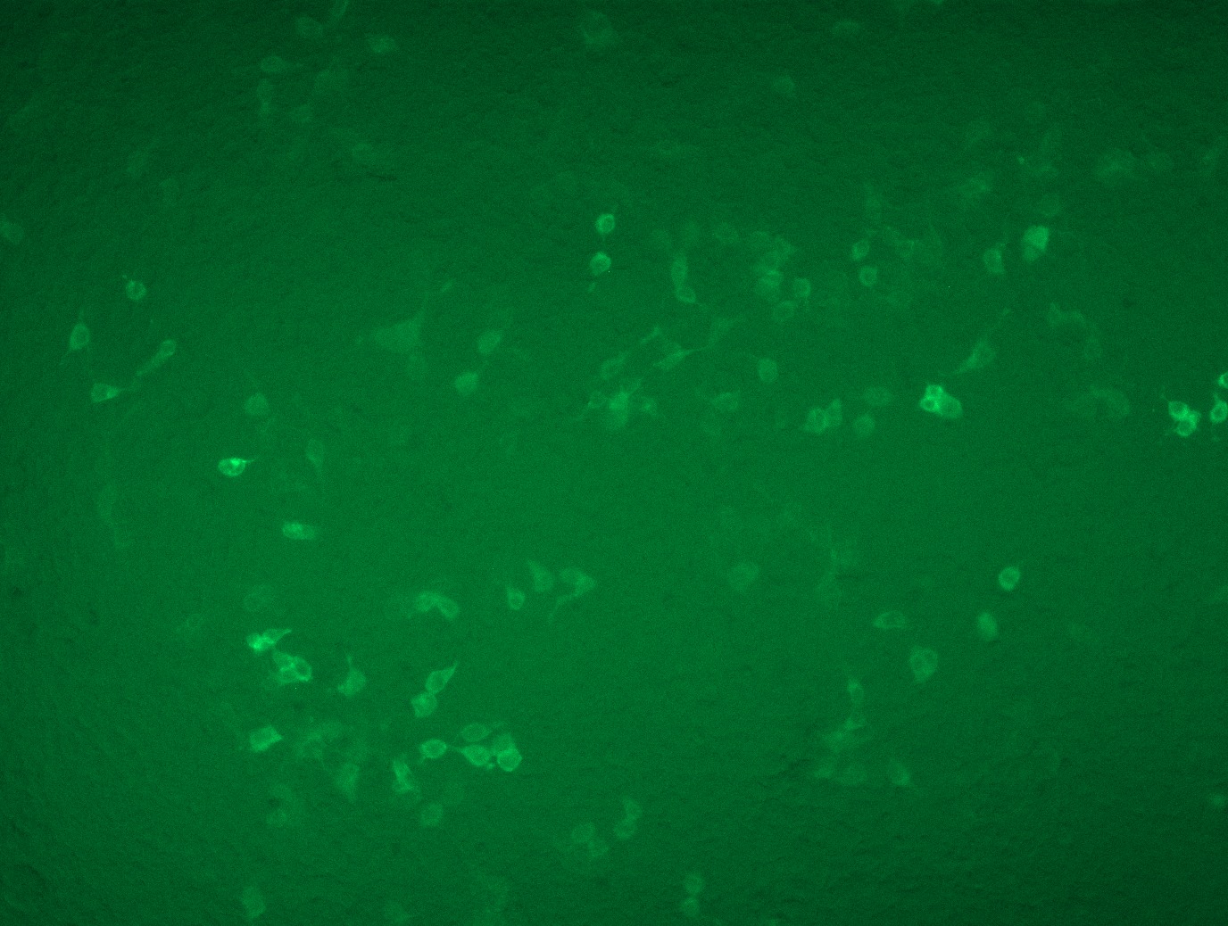 <a href = "https://www.origene.com/catalog/cdna-clones/expression-plasmids/rc208557l4-cd163-nm-004244-human-tagged-lenti-orf-clone" title="RC208557L4" class="">RC208557L4</a> was used to prepare Lentiviral particles using <a href = "https://www.origene.com/catalog/others/lentiviral-packaging-kits/tr30037-lentiviral-packaging-kits" title="TR30037" class="">TR30037</a> packaging kit. HEK293T cells were transduced with RC208557L4V particle to overexpress human CD163-mGFP fusion protein.