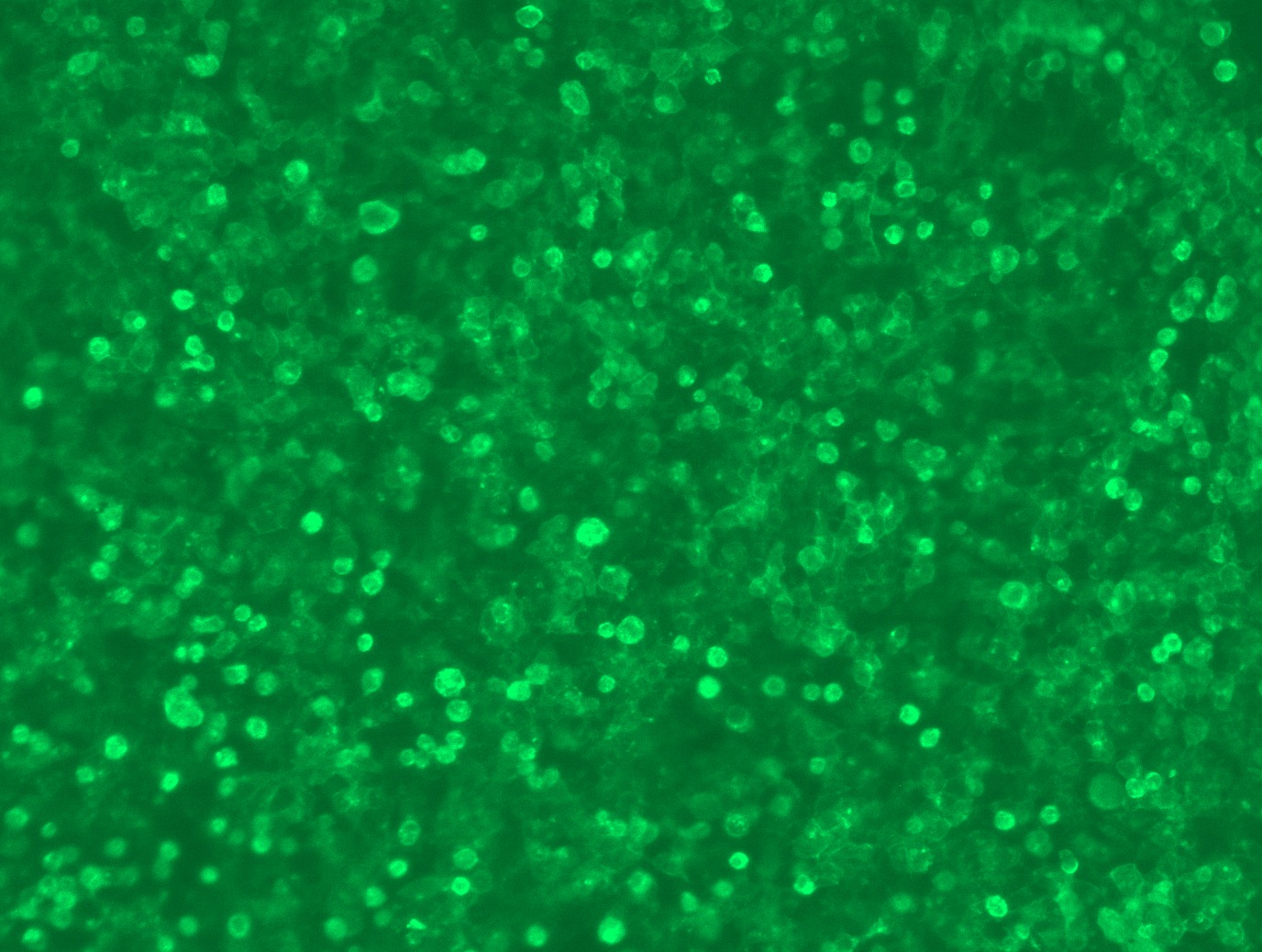 RC208851L3 was used to prepare Lentiviral particles using TR30037 packaging kit. HEK293T cells were transduced with RC208851L3V particle to overexpress human TNFRSF17-Myc-DDK fusion protein.