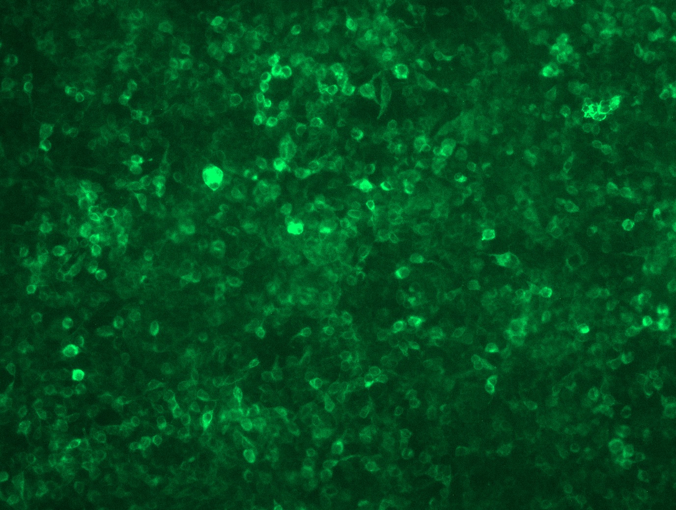 RC210360L3 was used to prepare Lentiviral particles using TR30037 packaging kit. HEK293T cells were transduced with RC210360L3V particle to overexpress human VTCN1-Myc-DDK fusion protein.