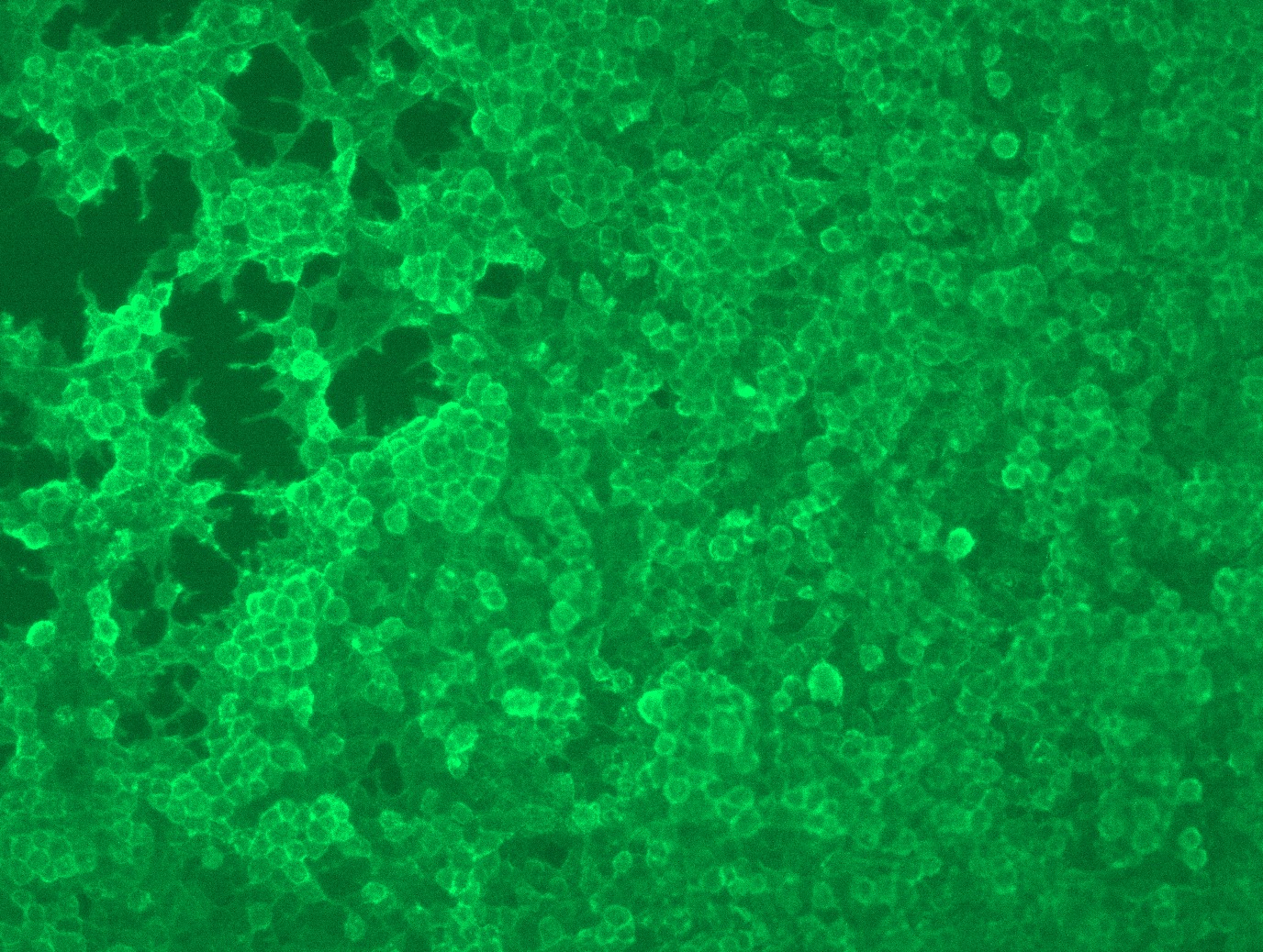 RC210364L3 was used to prepare Lentiviral particles using TR30037 packaging kit. HEK293T cells were transduced with RC210364L3V particle to overexpress human PDCD1-Myc-DDK fusion protein.