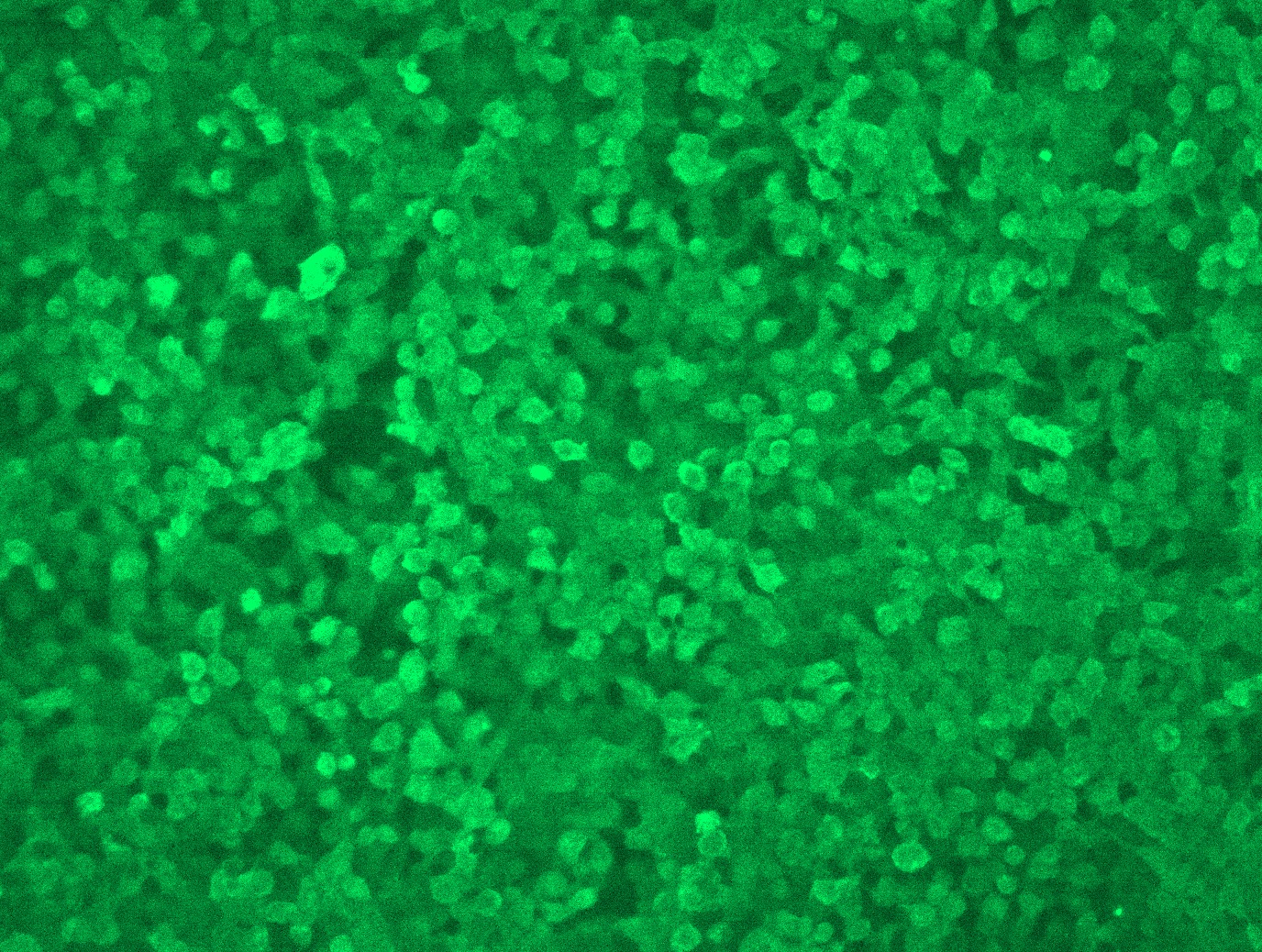 RC210606L3 was used to prepare Lentiviral particles using TR30037 packaging kit. HEK293T cells were transduced with RC210606L3V particle to overexpress human SNCA-Myc-DDK fusion protein.