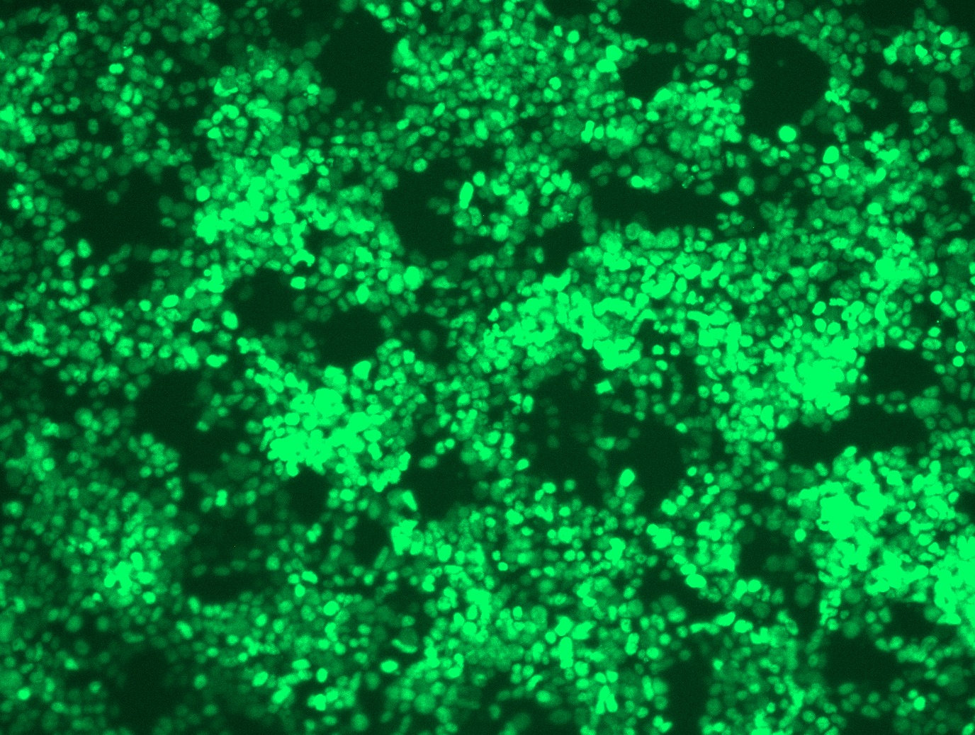 RC210639L2 was used to prepare Lentiviral particles using TR30037 packaging kit. HEK293T cells were transduced with RC210639L2V particle to overexpress human TARDBP-mGFP fusion protein.